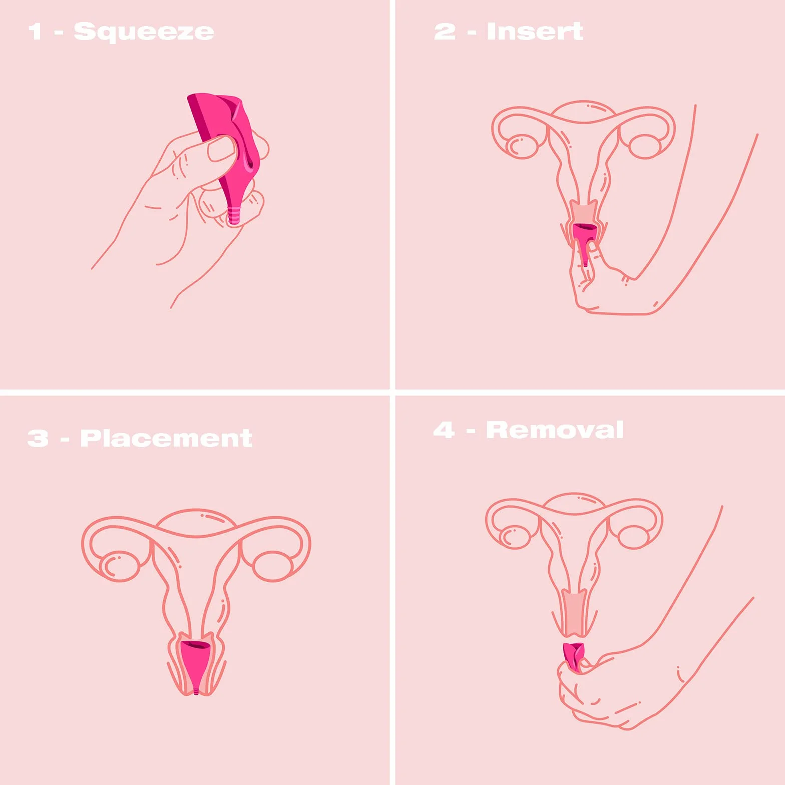 Intimina Lily Cup Size B: Coppetta Mestruale Sottile, Menstrual Cup Utilizzabile per un Massimo di 8 ore, Coppa Mestruale per Raccogliere il Flusso, Coppetta Mestruale Morbida