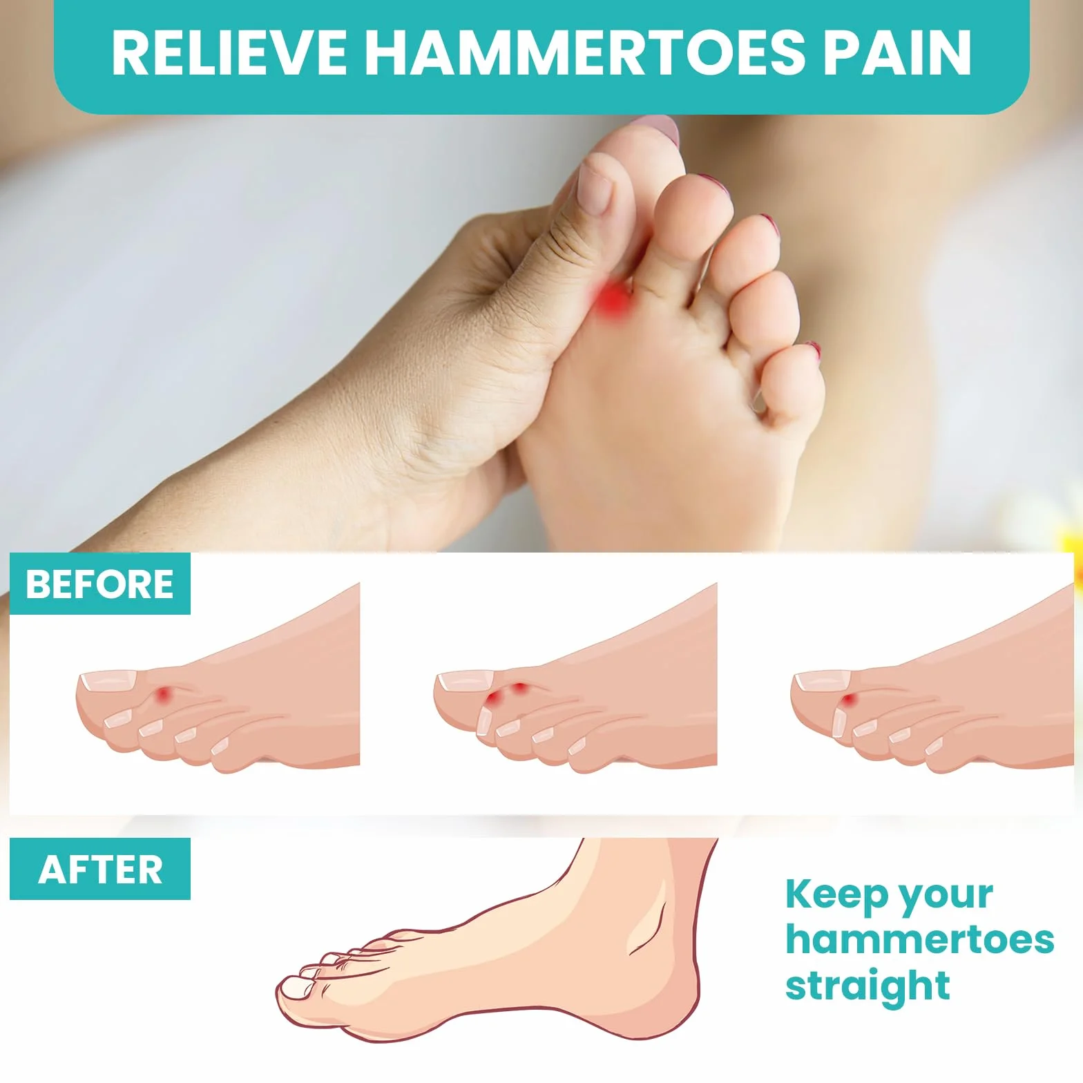 Promifun Separatori per dita dei piedi in gel morbido, 2 paia, correzione fascite plantare (Trasparente +L)