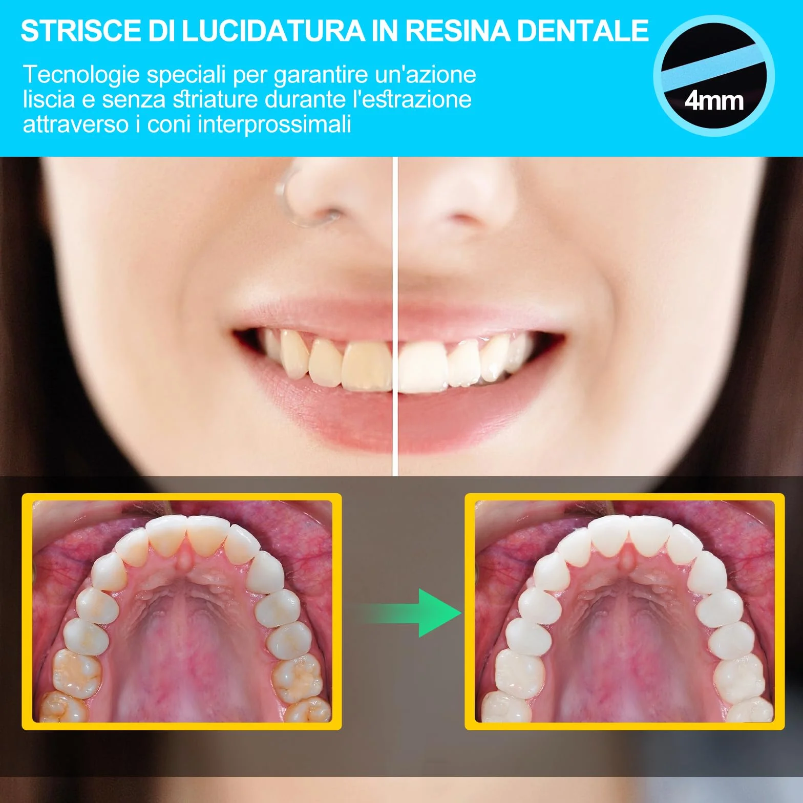 AISEELY Strisce Sbiancanti Denti, Sbiancante Denti di Strisce per Lucidatura Dentale, 1pcs 6m/Rotoli/Scatola di Carta Vetrata per Pulizia Denti, 4mm di Spessore Sbiancante Denti Professionale Kit