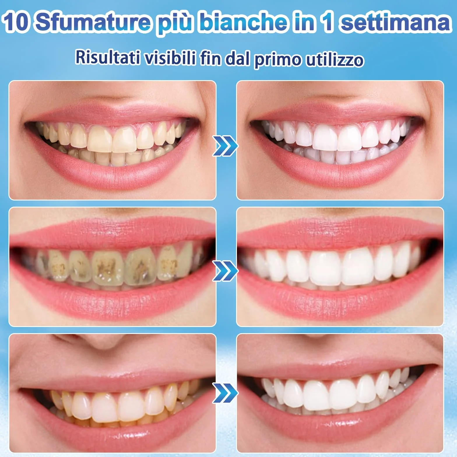Profesjonalny zestaw penna sbiancante per denti (4 penne), gel sbiancante dentale, sbiancanti denti istantanei