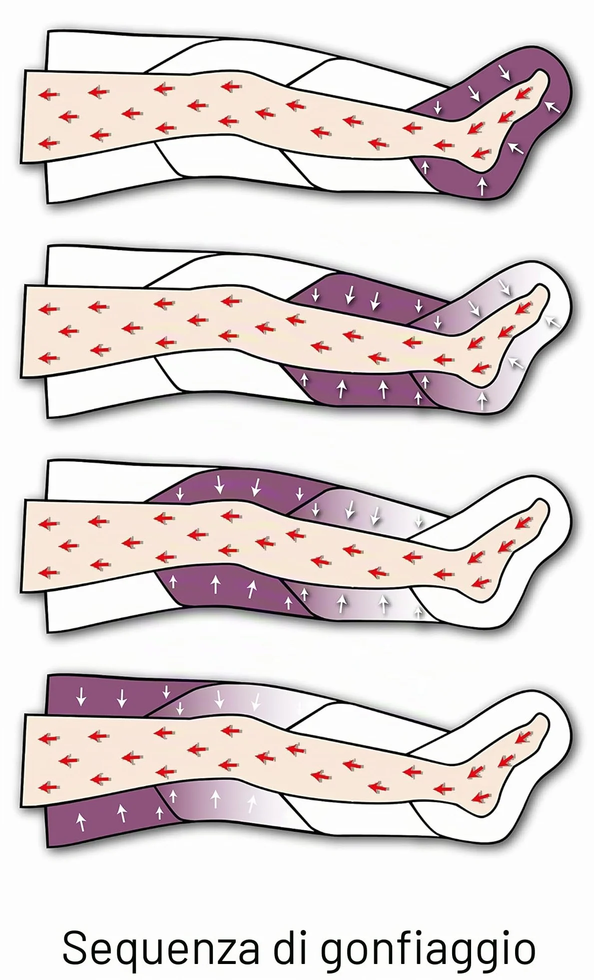 MESIS Pressoterapia Professionale Per Casa PressoMassaggio Plus+ (con 2 gambali e Kit Slim Body) Pressoterapia Linfodrenaggio Anti Cellulite Pressoterapia