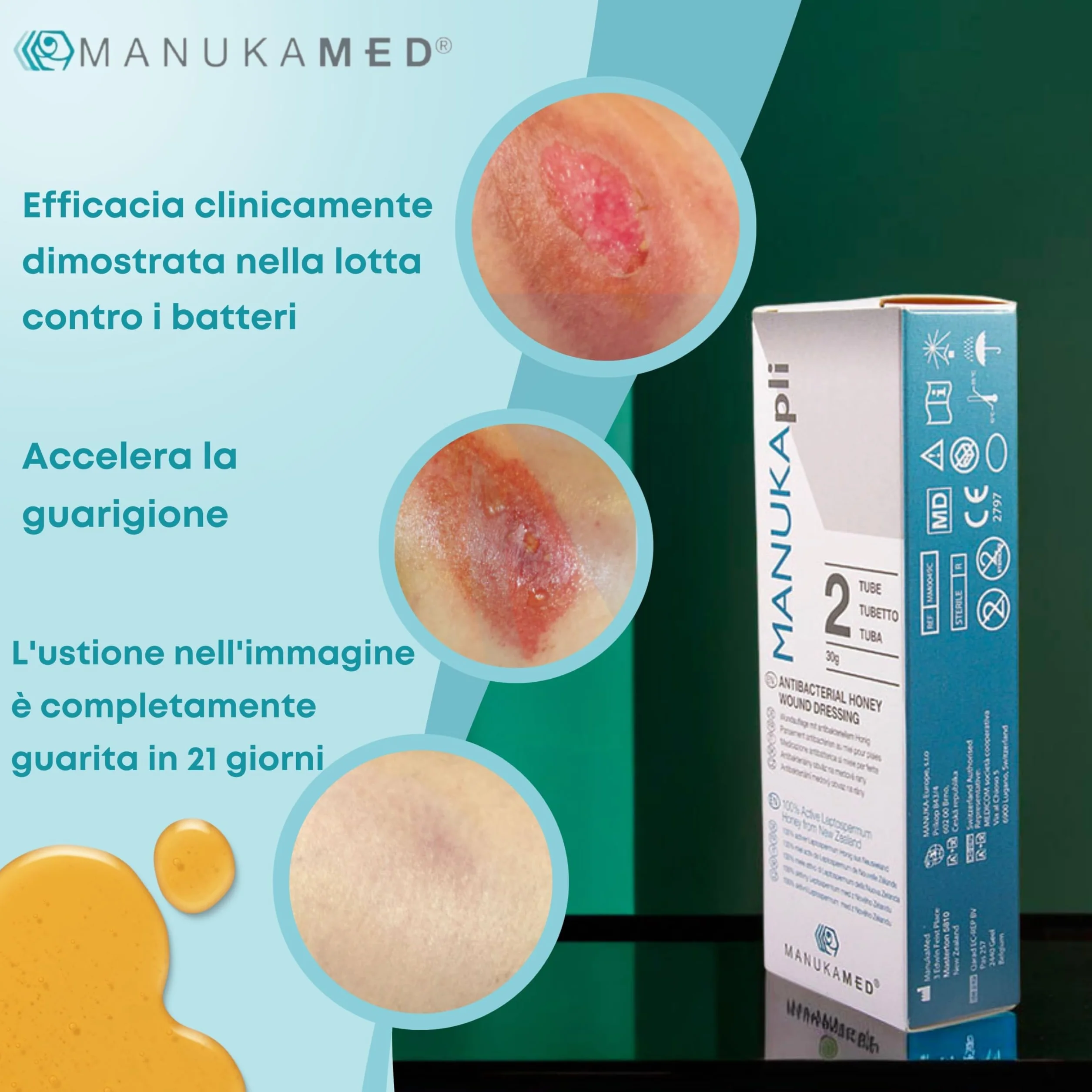ManukaMed MANUKA, qualità medica, cura delle ferite e della pelle, miele di Manuka bioattivo al 100%, unguento per le ferite e la guarigione, STERILE MGO 560+/2x15 g