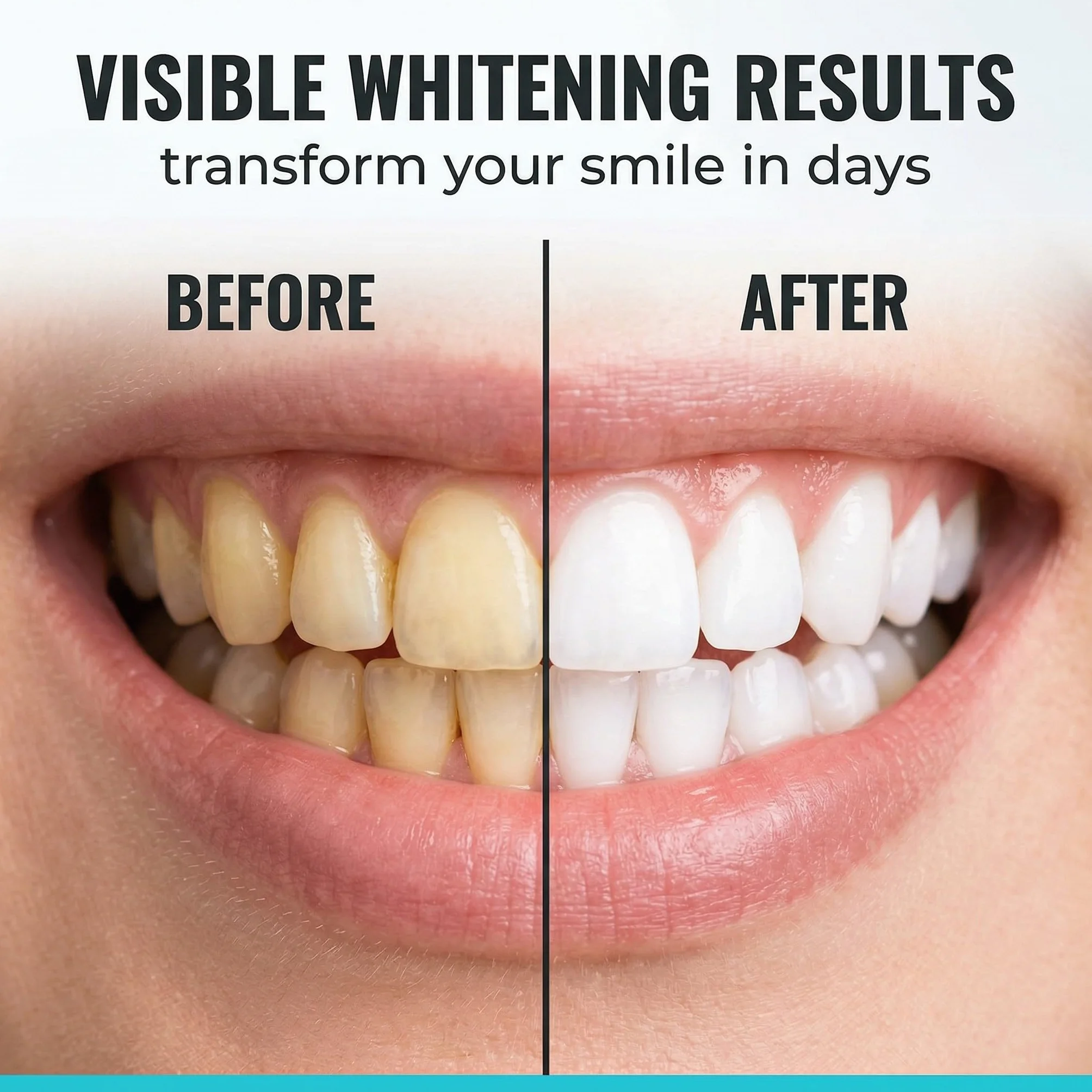 7 Pezzi Cocco Strisce Sbiancanti Denti, Senza Teeth Sbiancamento Dei Denti, Whitening Strips Per Sbiancamento Delicato, Facile Uso A Casa O In Viaggio