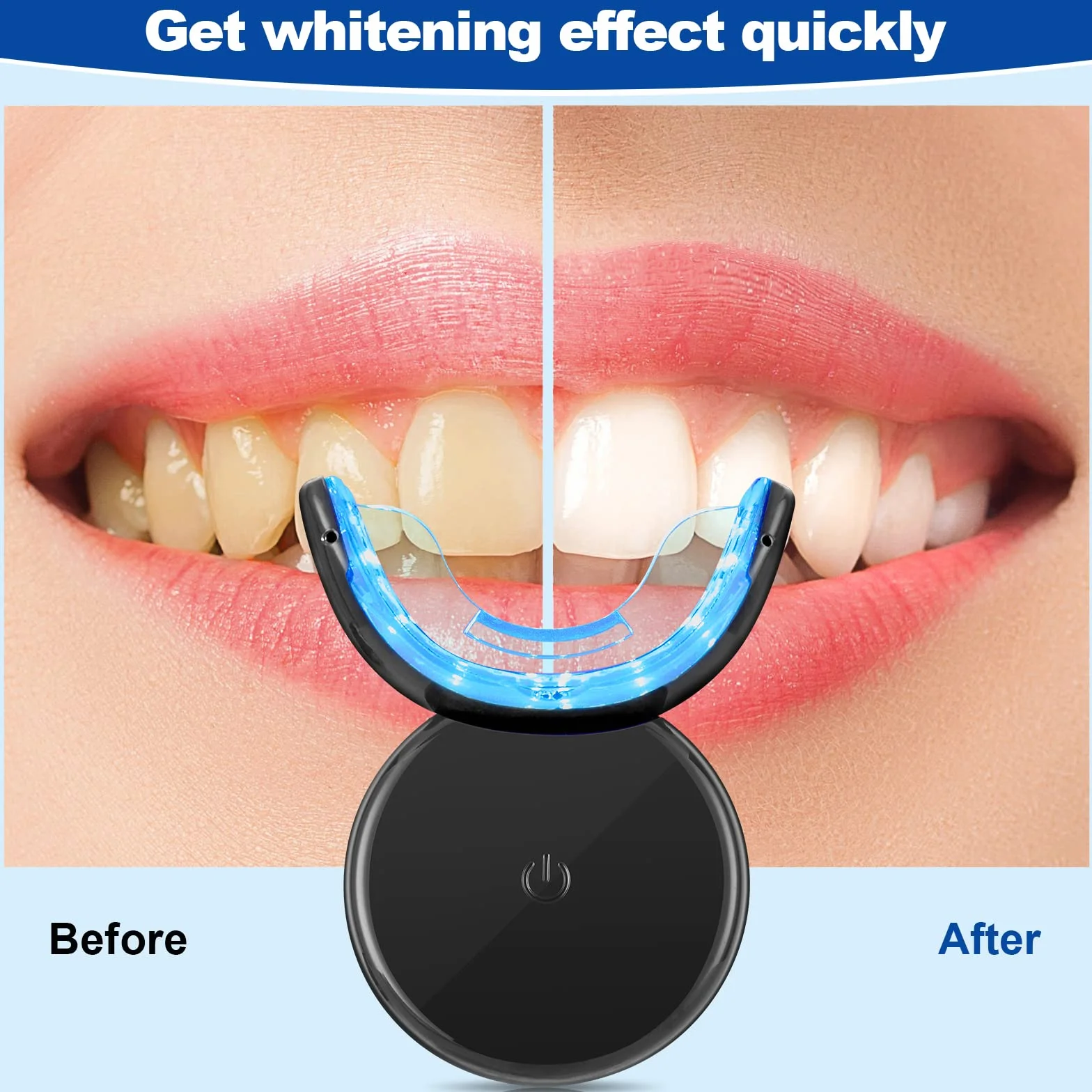 Kit Sbiancante Denti Professionale con Lampada LED - Teeth Whitening