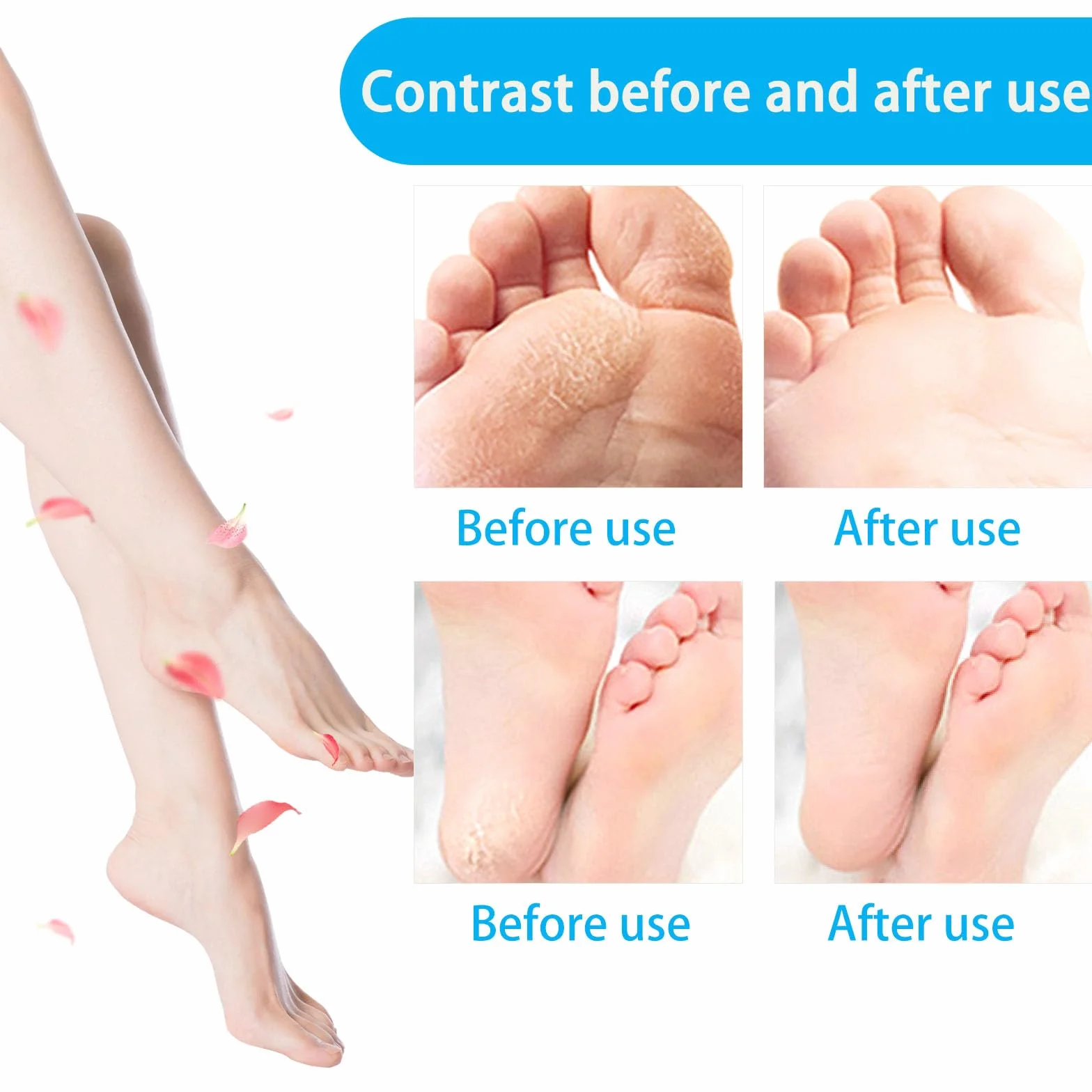Scholl Velvet Smooth Rullo Ricambio Compatibile, Roll Ricariche Professionale Pedicure Elettrico, 3 Rugosità, Pietra Pomice Raspa Piedi