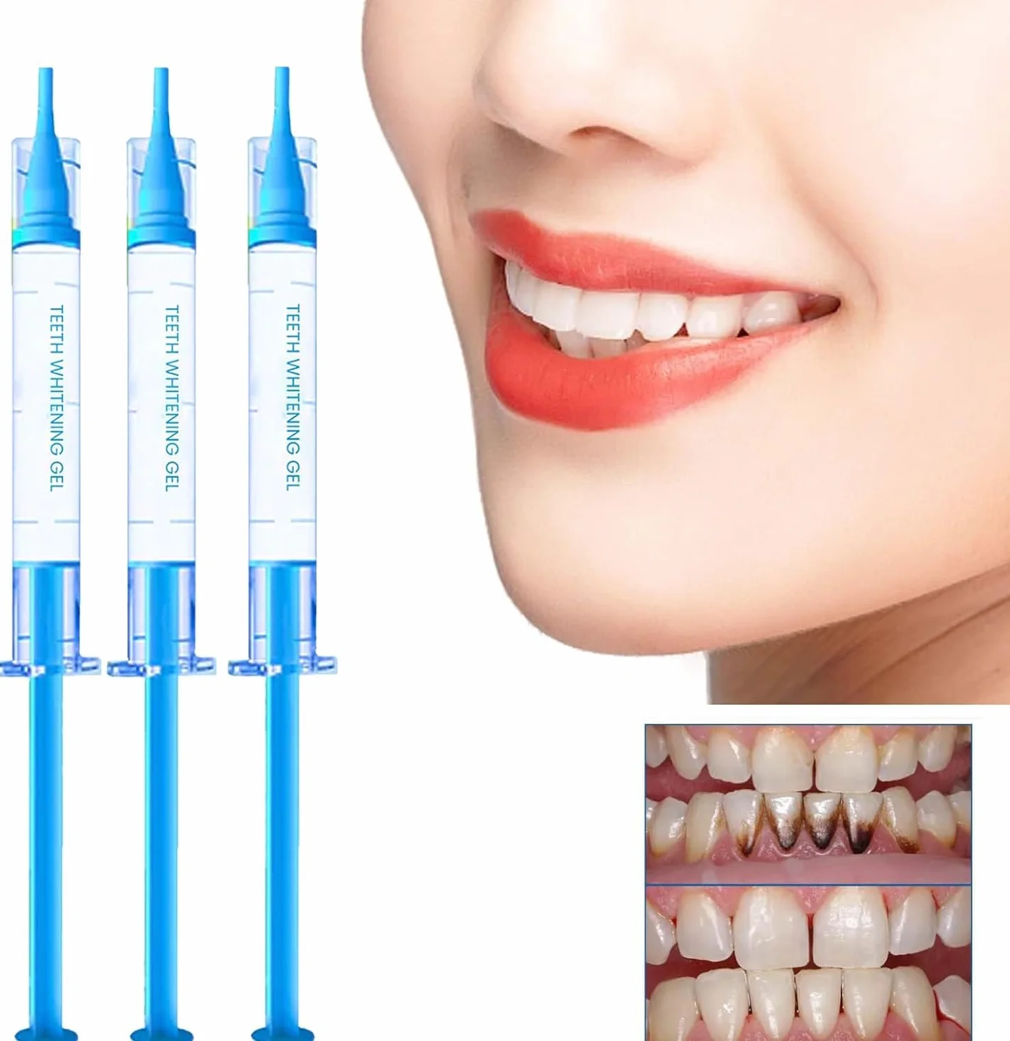 Gocce Rigenerazione Gengivale 30ML