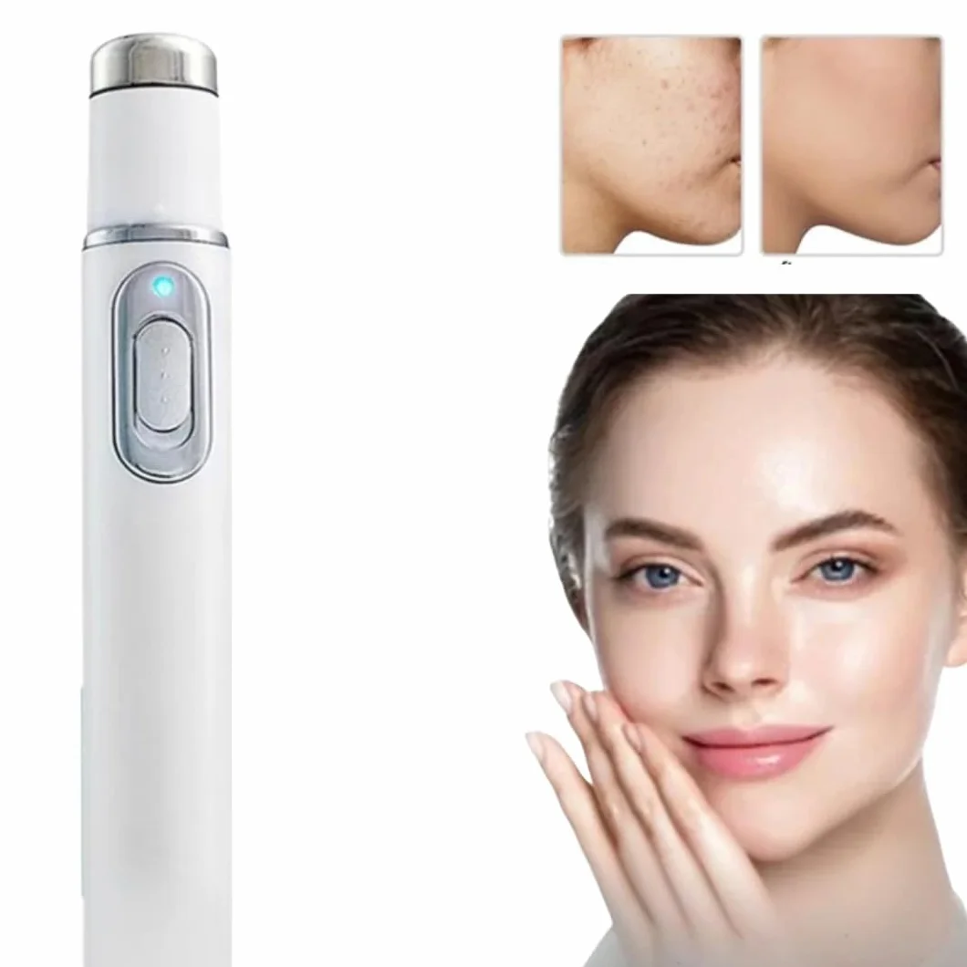 Generico Dispositivo Non Invasivo per Il Trattamento delle Vene Varicose, Apparecchiatura Laser per Il Trattamento delle Vene Varicose, Dispositivo Laser per Vene Varicose A Domicilio (1x - Single)