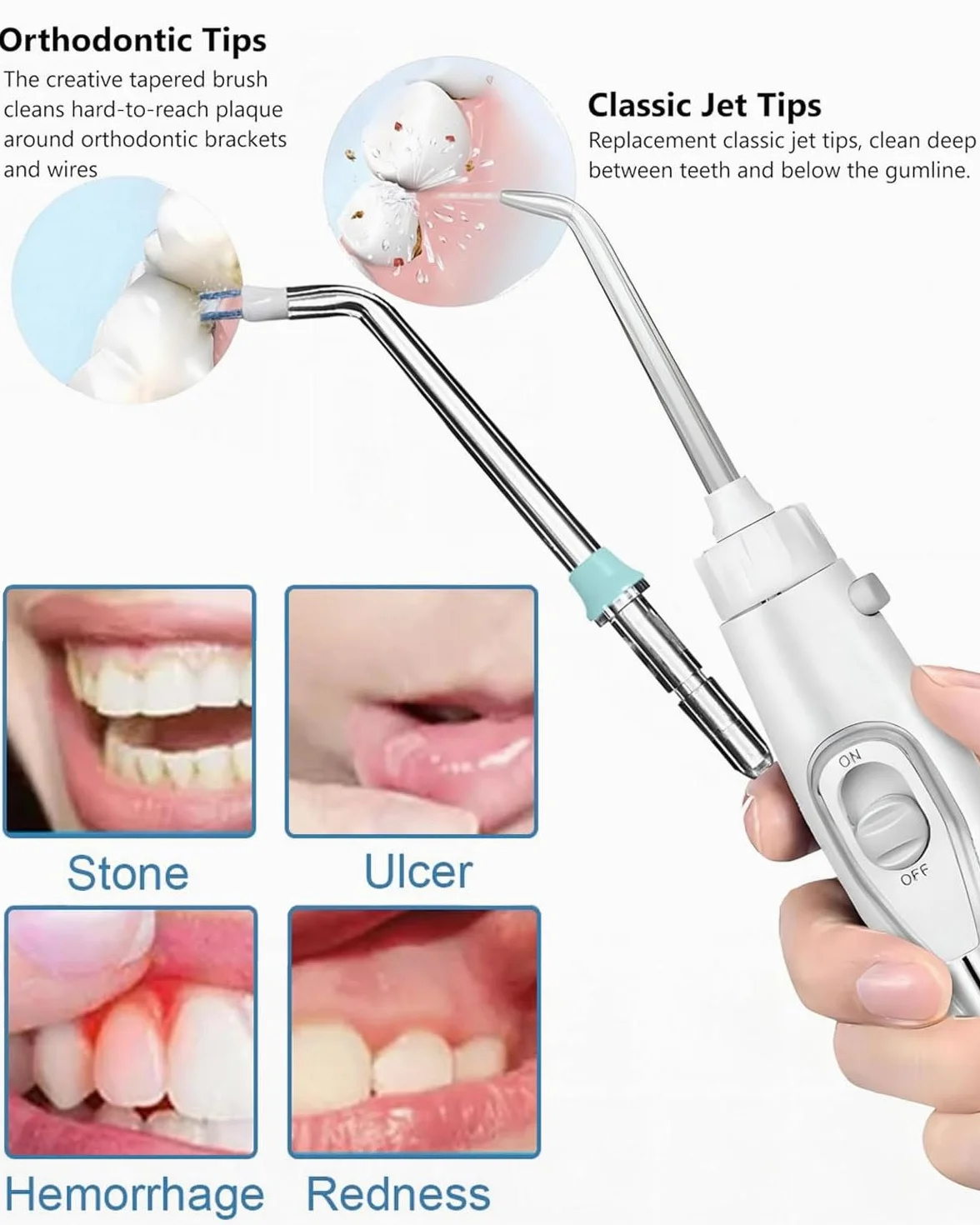 Set di 3 Punte di Ricambio per Idropulsore Dentale, Ugelli Compatibili con perWaterpi WP-100, WP-660 e Altri Modelli, Accessori per Irrigatori Orali, Spruzzo Acqua Dentario
