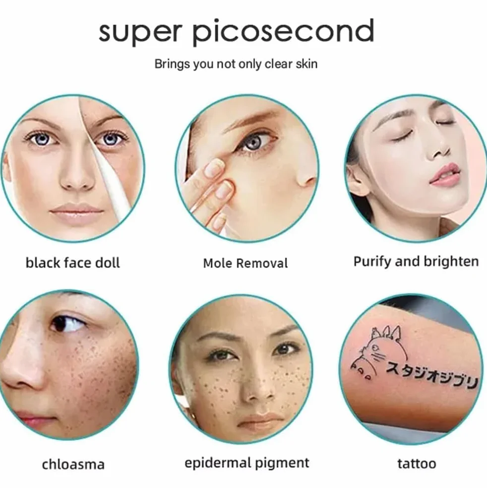 2 in 1 attrezzatura del salone di bellezza per depilazione laser a diodi 808nm, rimozione del tatuaggio picosecondo per ringiovanimento della pelle