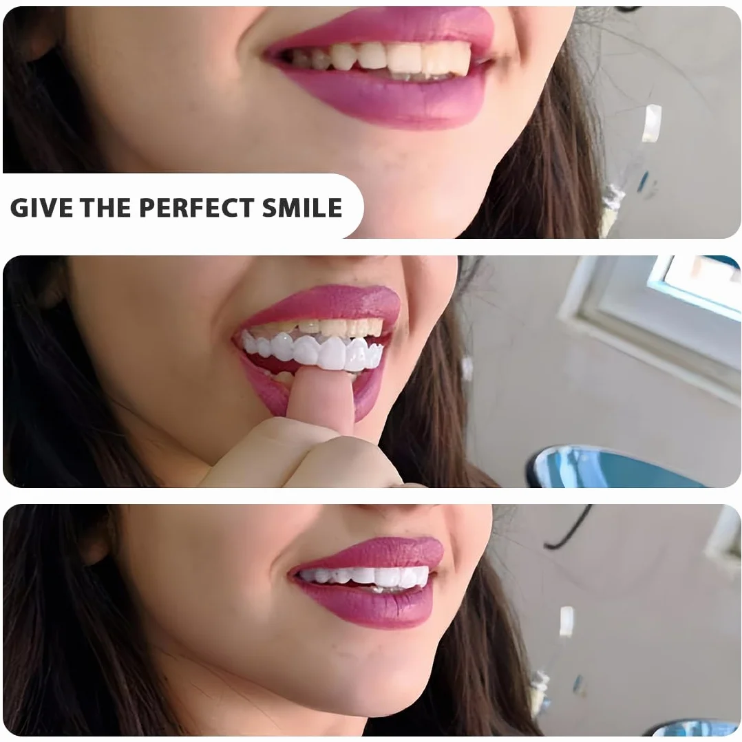 Faccette Denti Finti a Scatto Superiore e Inferiore, Protesi Dentarie Cosmetiche Temporanee
