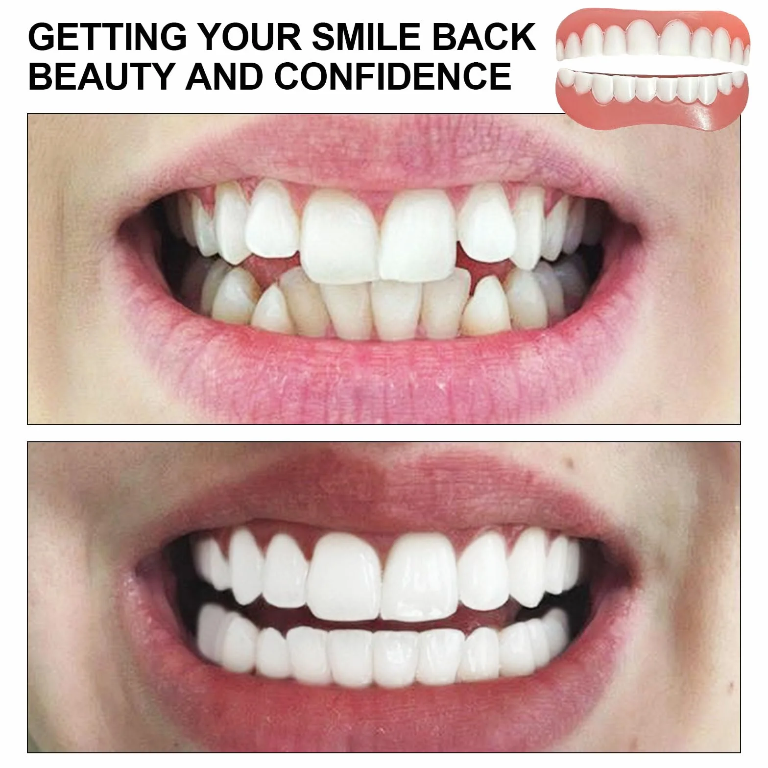 EUPSIIU Faccette Istantanee Denti Finti Cosmetici, Protesi Dentale Superiore Inferiore per Sorriso