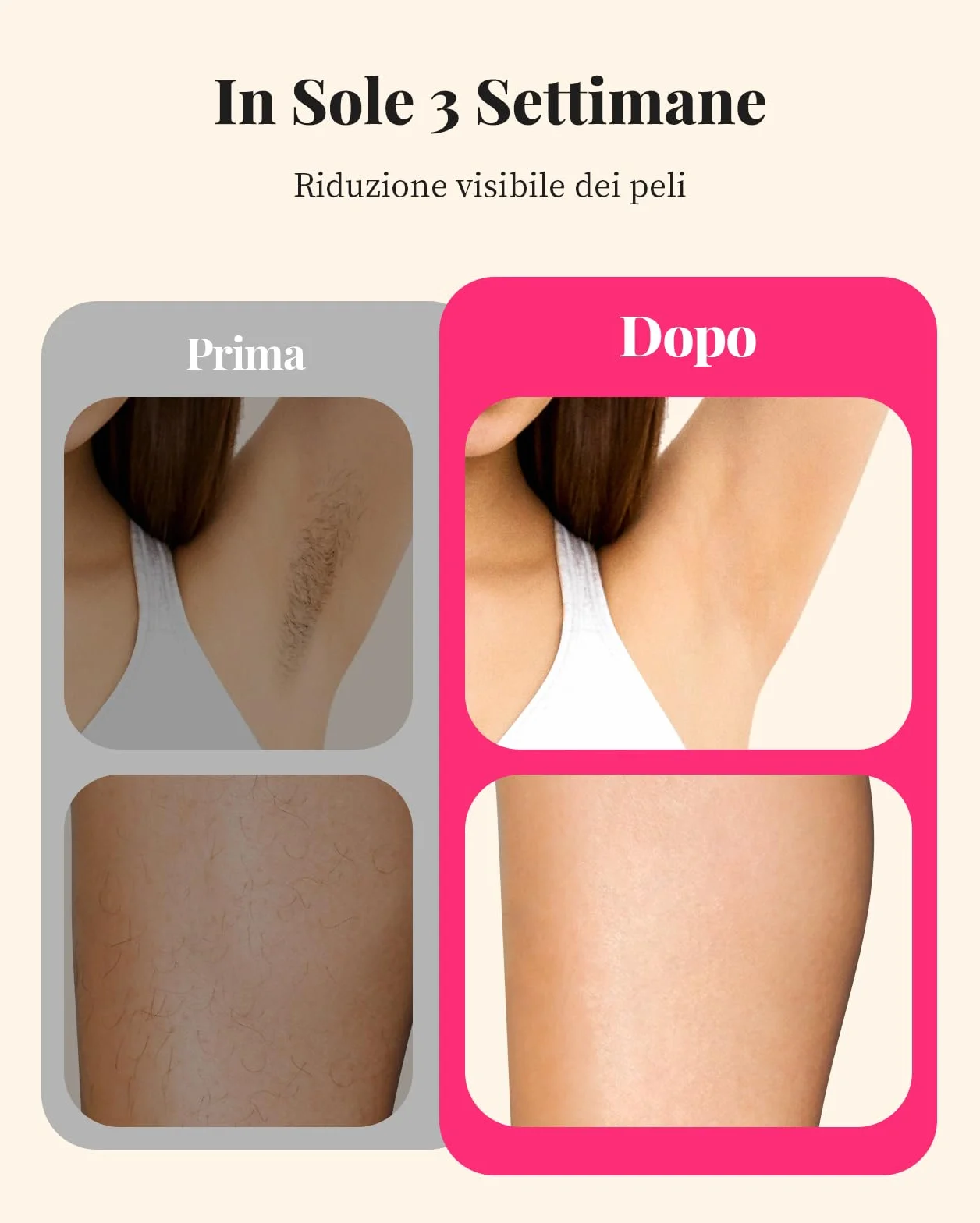 Haarlosy Epilatore Luce Pulsata con Tecnologia IGBT 3 IN 1 HR/SR/HR+ GLY03 | Epilatore Laser Professionale, 9 Livelli di Energia Regolabile Adatto Depilatore Corpo, Viso, Ascelle, Gambe
