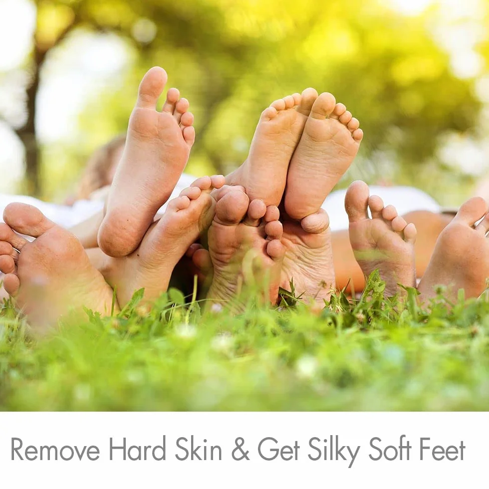 Pietra pomice per la cura dei piedi Scruber Dead Hard Skin Remover Pedicure Tool esfoliante pelle dura (confezione da 2)