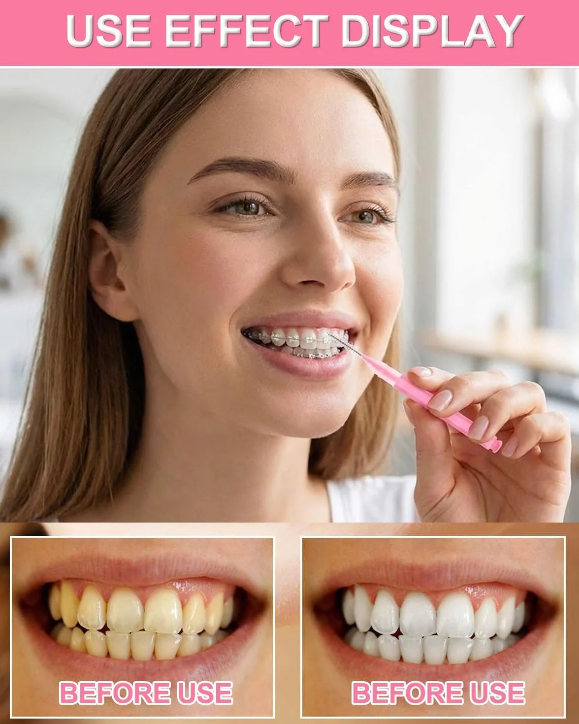 50 Pezzi Scovolini Interdentali,Scovolino per Pulizia Denti con Coperchio per Apparecchi Dentali,Scovolino Denti Morbido per Pulizia Interdentale,L'Igiene Orale(10 Colori)