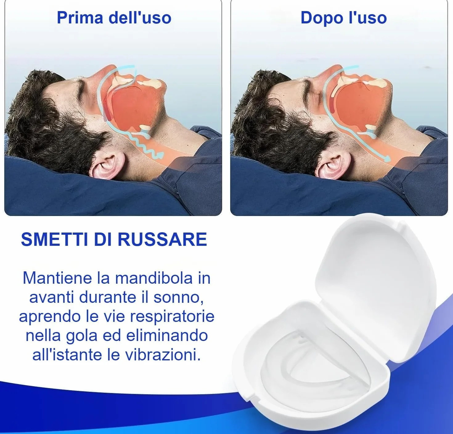 Rinovax Bite Antirussamento-Dispositivo Antirussamento Rinovax - Supporto per un Sonno Sereno,Aiuta a Ridurre il Russare,Migliorare la respirazione e il comfort,Facile Da Pulire (1PCS)