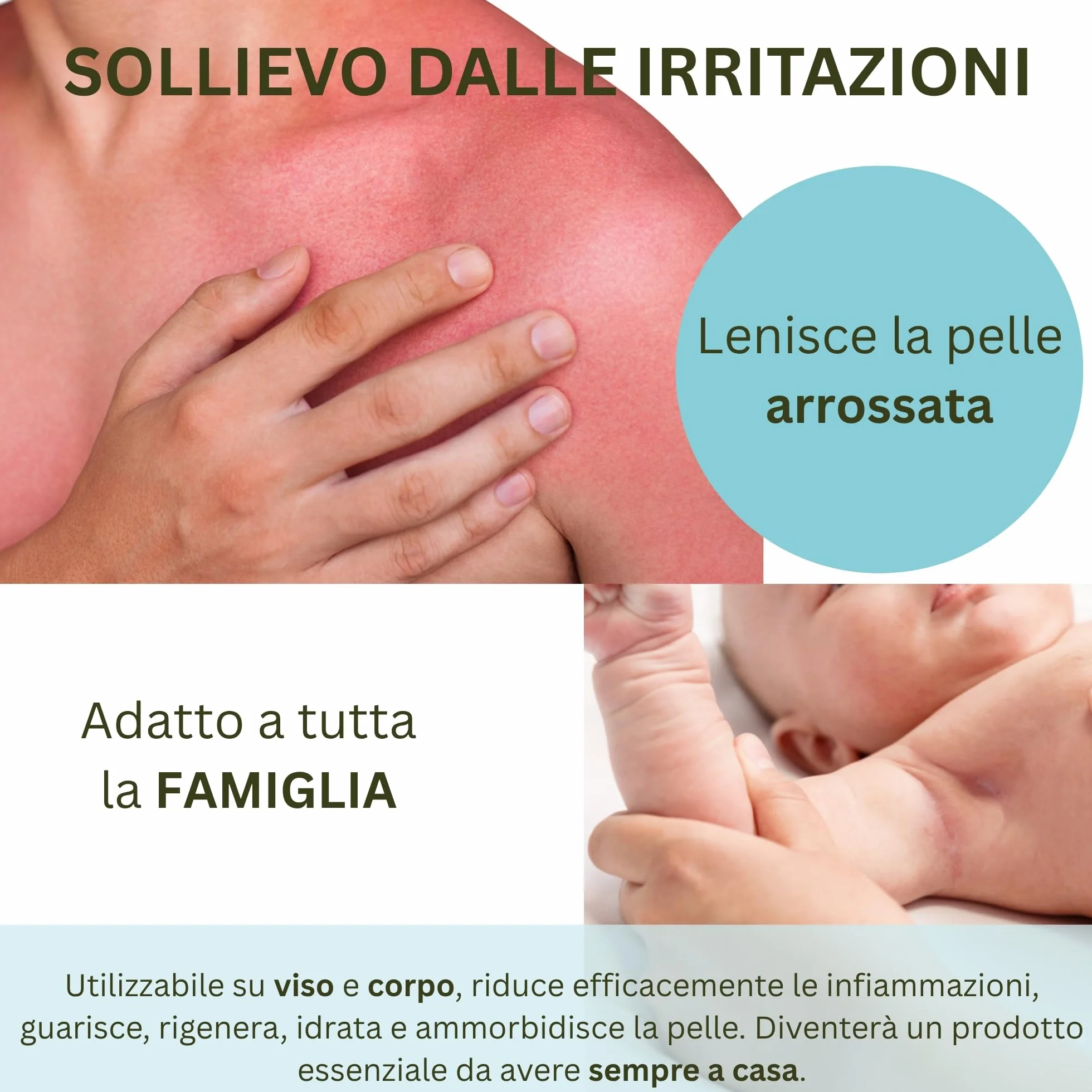 Kefus Crema Calamina con Dexpantenolo, Allantoina e Vitamina E. Astringente, assorbente e protettiva per la pelle. Previene e migliora le eruzioni cutanee, allevia le punture di insetti e meduse. 75 g