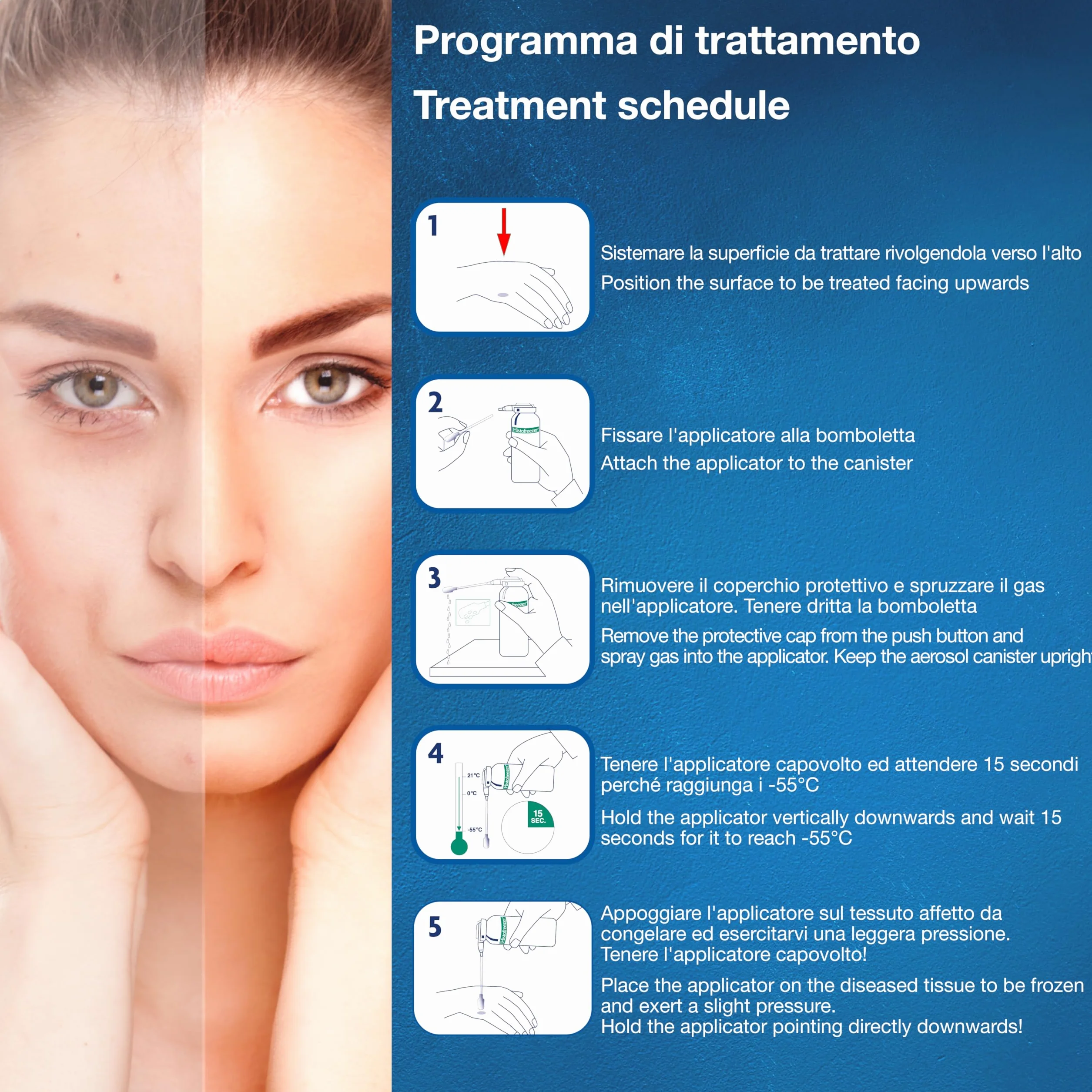 Kit 2 Flaconi 80 ml con 52 applicatori 5 mm, 30592