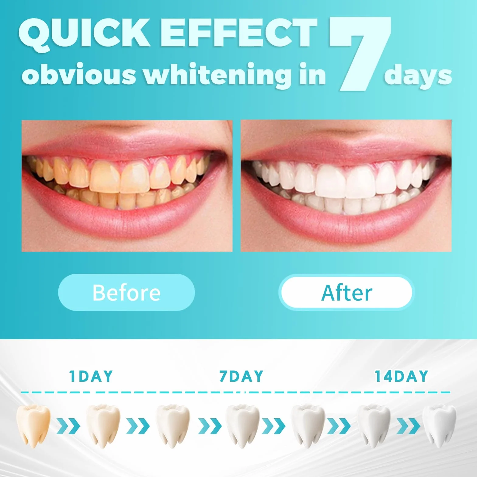 28 Strisce Sbiancanti Denti, Sbiancamento denti professionale, sbiancante denti Rimozione delicata delle macchie dentali, whitening strips Rimuove le Macchie Profonde Sicuro per Denti Smalto
