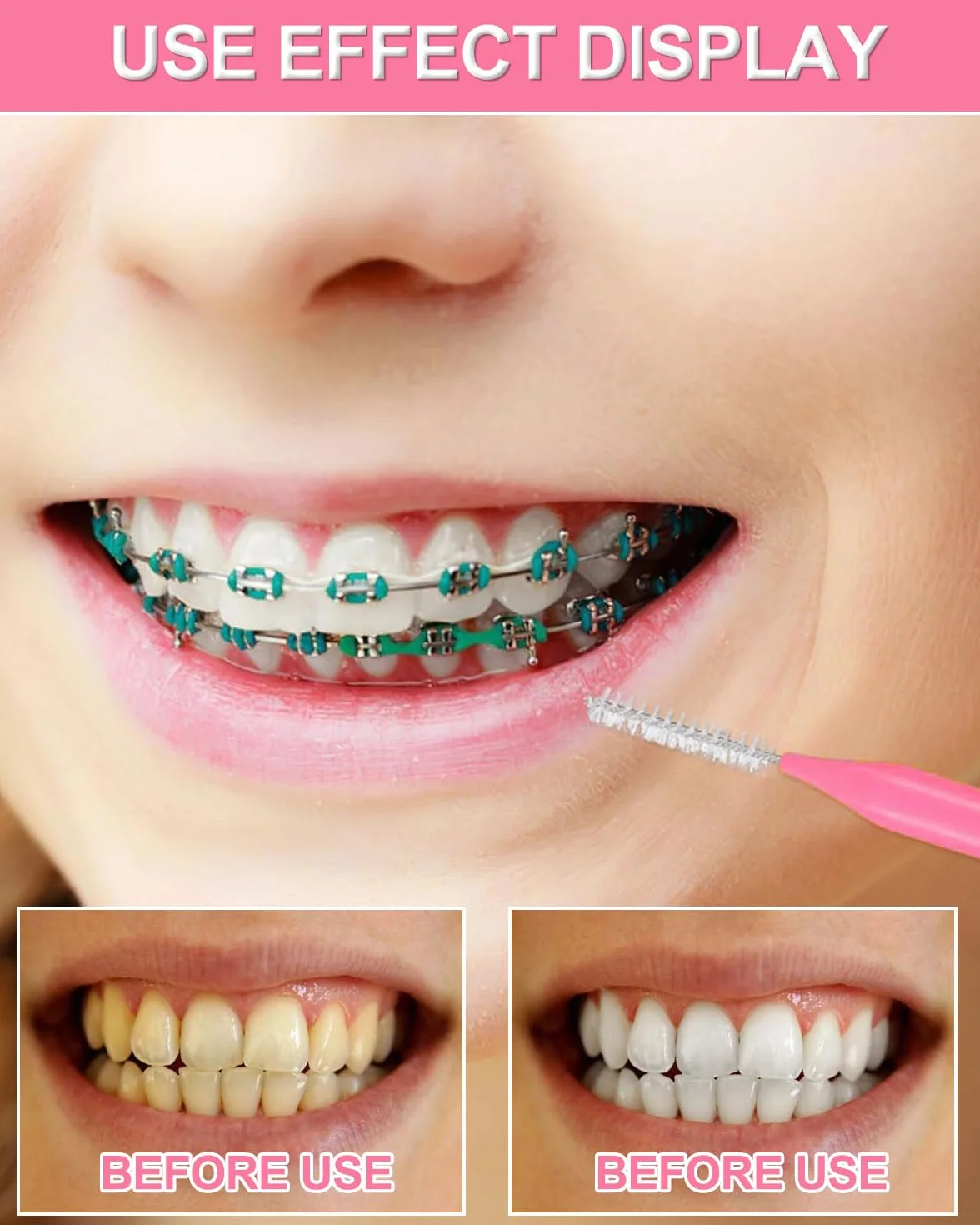 Scovolini Interdentali 50 Pezzi, Scovolino per Pulizia Denti con Coperchio, Pulire Spazi Stretti Tra Denti, Strumenti Pulizia Denti, 5 Colori