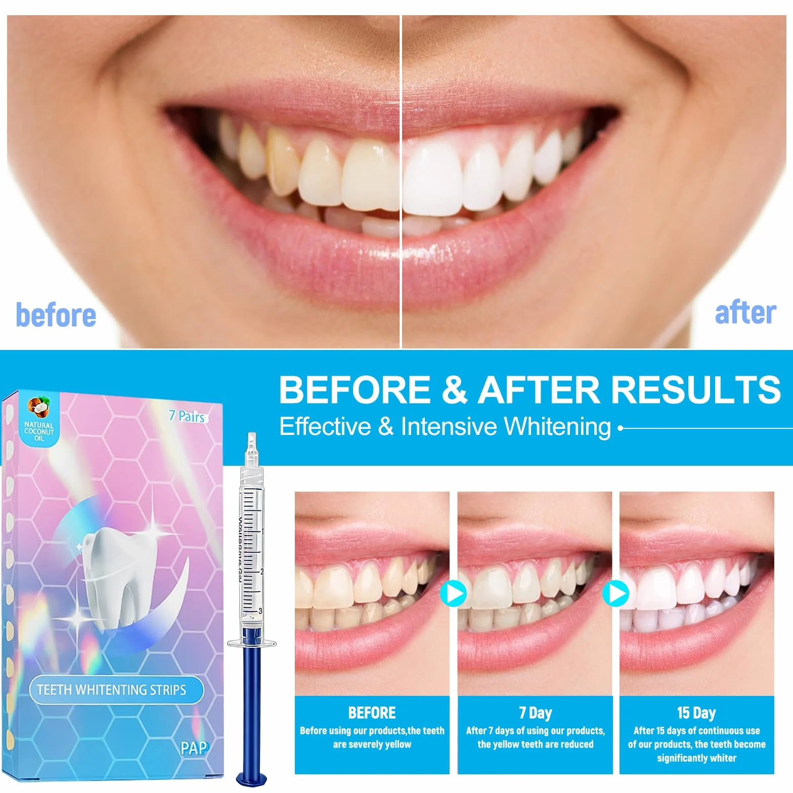 Kit Sbiancante Denti Professionale,7 pezzi Gel Denti sbiancante,Strisce Sbiancanti denti Professionali,Set Sbiancante per denti a Casa,con applicazione semplice e veloce