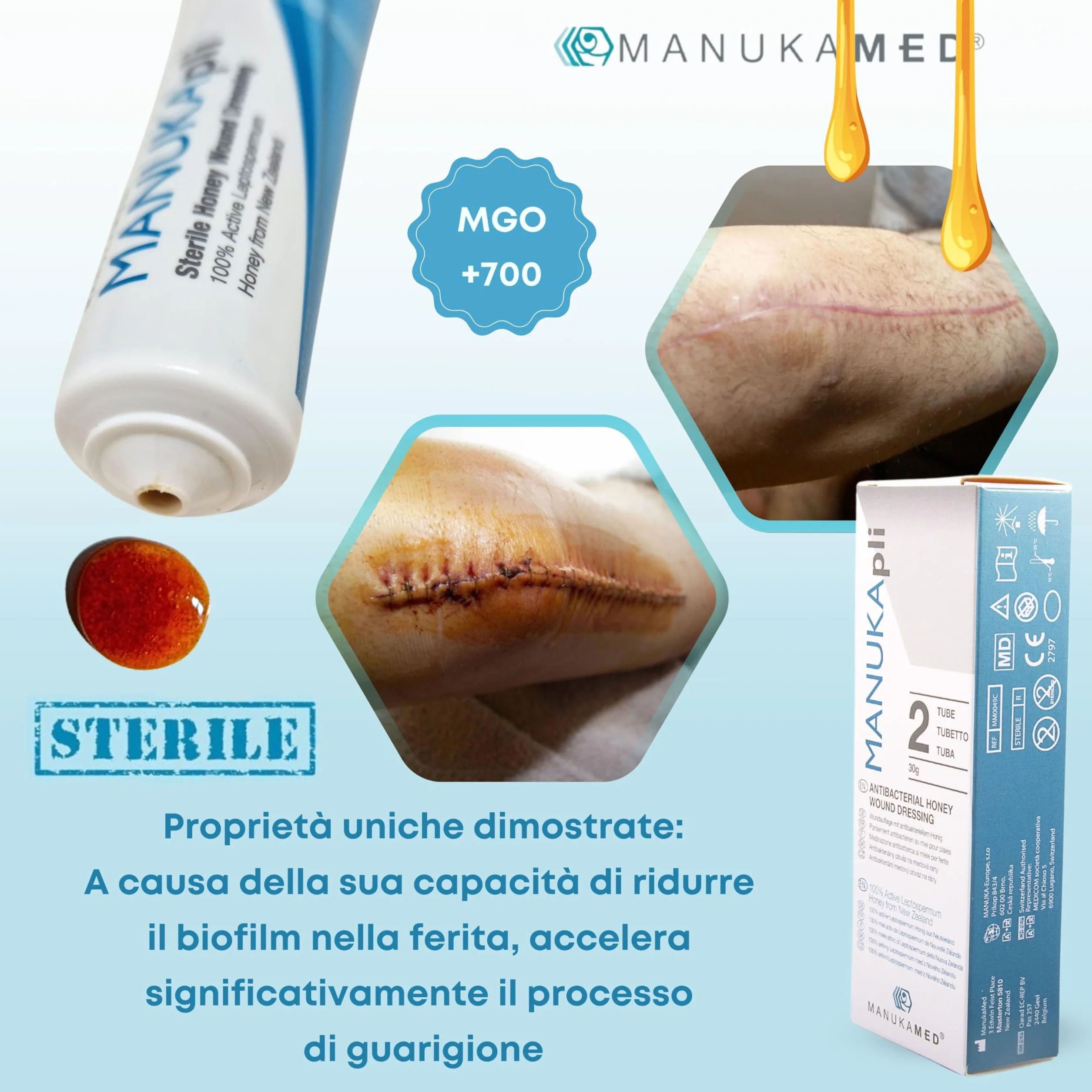 ManukaMed MANUKA, qualità medica, cura delle ferite e della pelle, miele di Manuka bioattivo al 100%, unguento per le ferite e la guarigione, STERILE MGO 560+/2x15 g