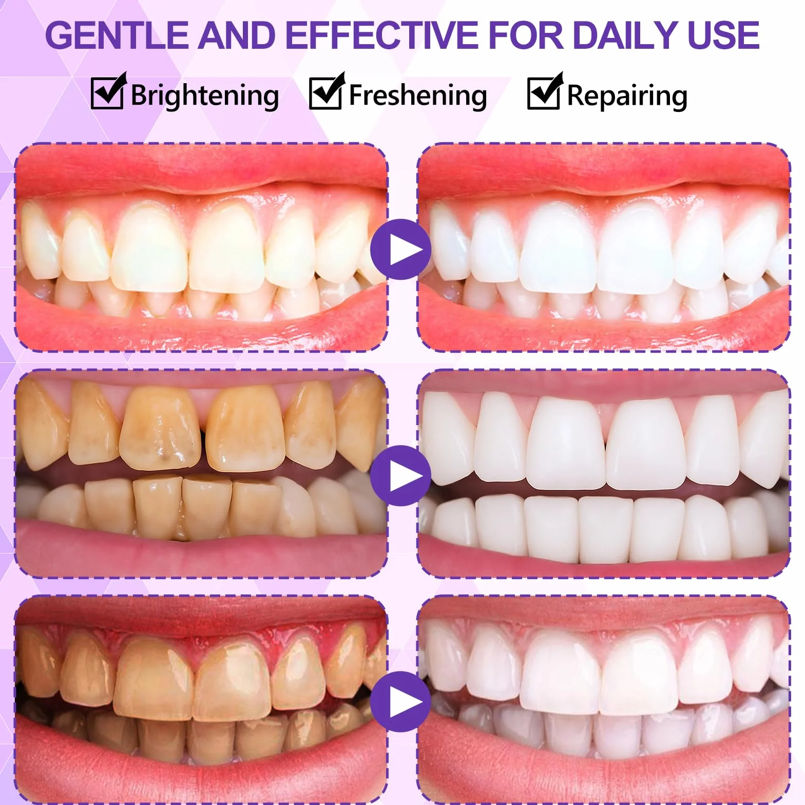 14 Paia Strisce Sbiancanti Denti Viola, Strisce Sbiancanti Denti Professionale, Sbiancamento Dentali Rapido A Casa, Rimuove Le Macchie Profonde, Ideali Sorriso Bianco E Luminoso