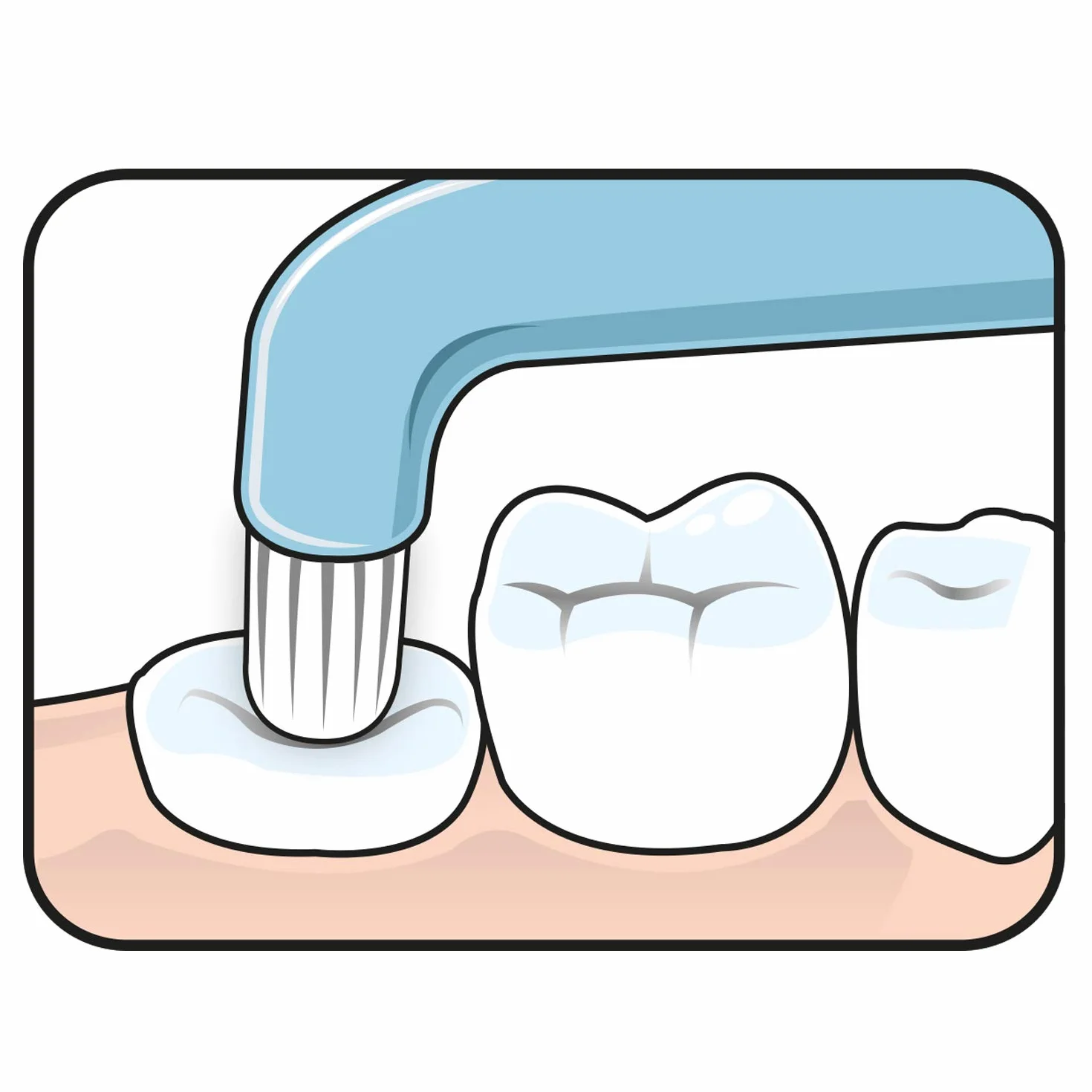 TEPE Compact Tuft Spazzolino da denti con testina rotonda per una pulizia accurata della bocca anche in impianti o protesi colorati Assortiti
