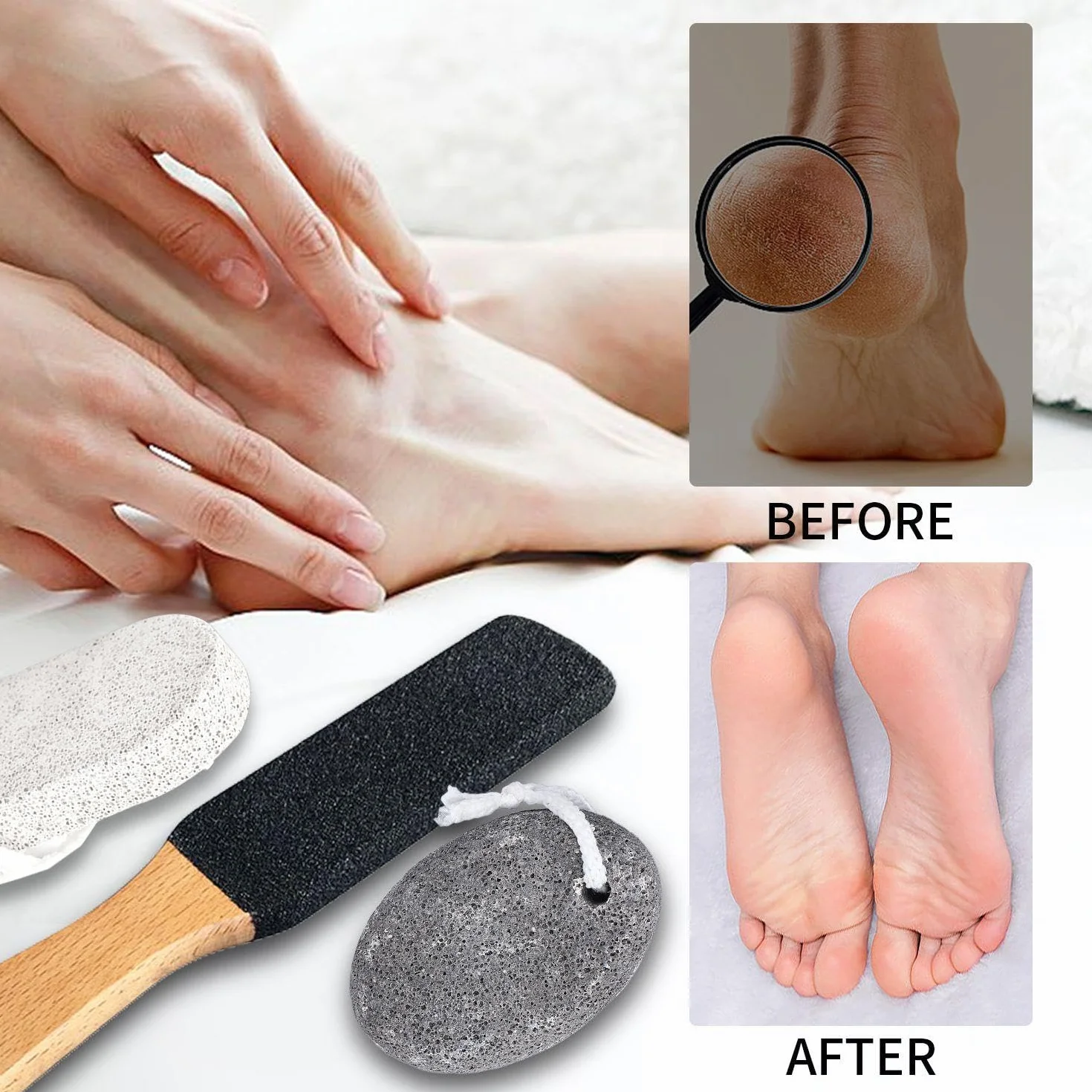 Levigapiedi in 3 Pezzi, Strumenti per Pedicure, Cura dei Piedi
