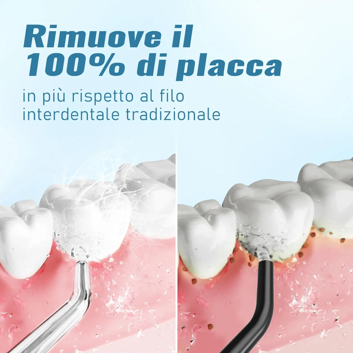 AUIEI Idropulsore dentale senza fili, irrigatore orale IPX7, serbatoio 300 ml, 5 modalità, 8 ugelli, Nero