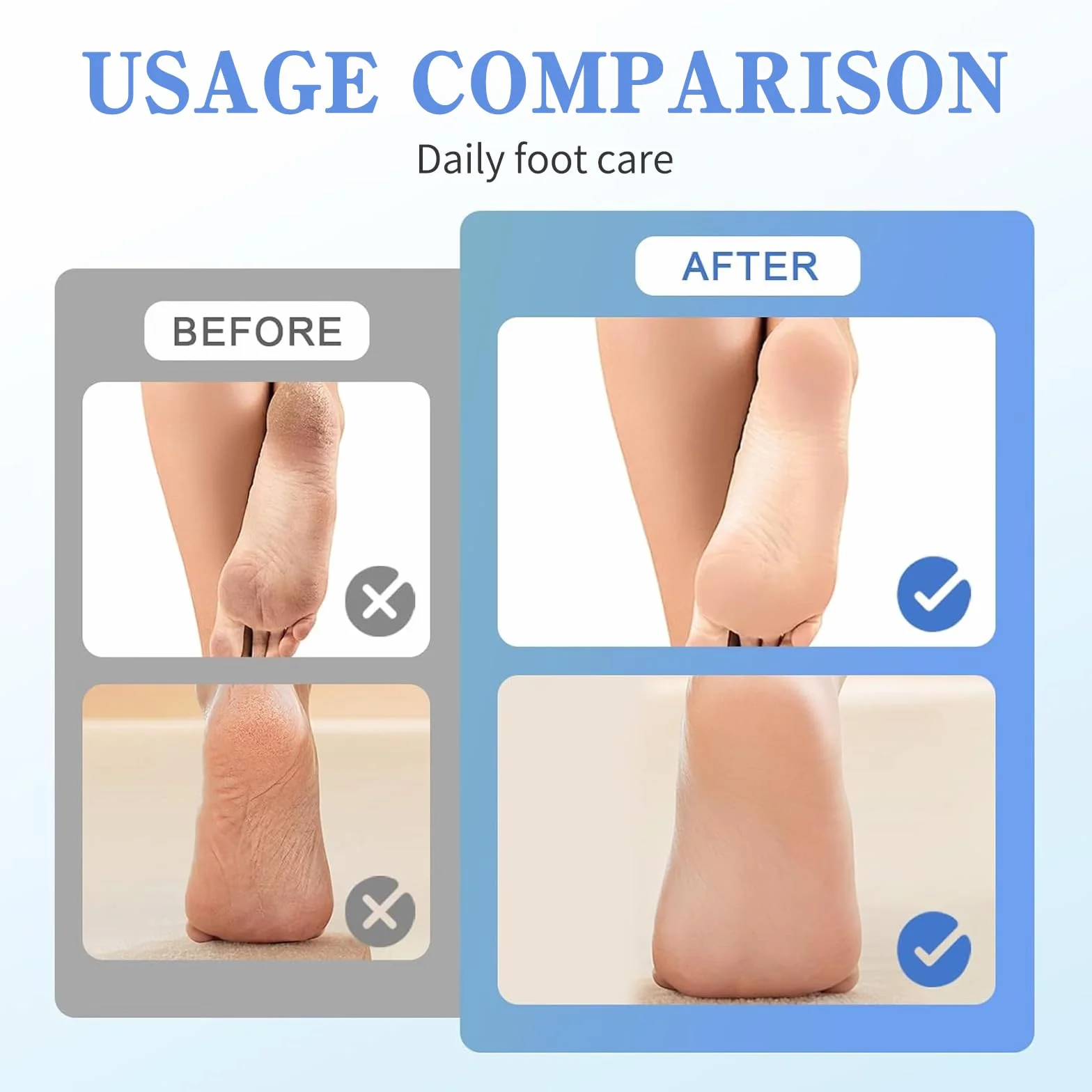 Pedicure Elettrico Professionale Velocità Regolabile Rimuovi Calli per Pelle