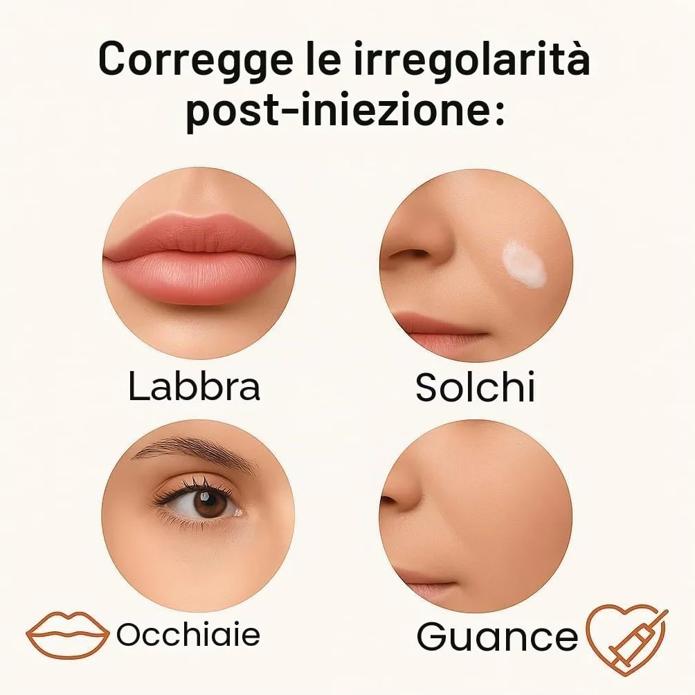 SoftFil Topilase Trattamento dermo-regolatore post filler 3 ml