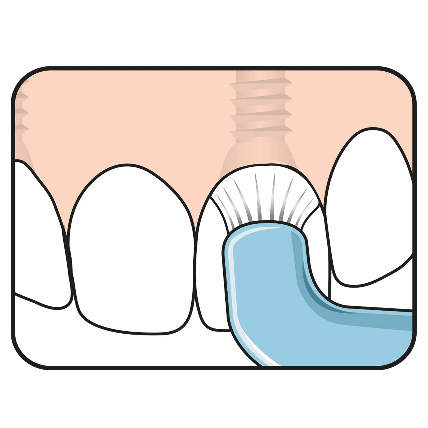 TEPE Compact Tuft Spazzolino da denti con testina rotonda per una pulizia accurata della bocca anche in impianti o protesi colorati Assortiti