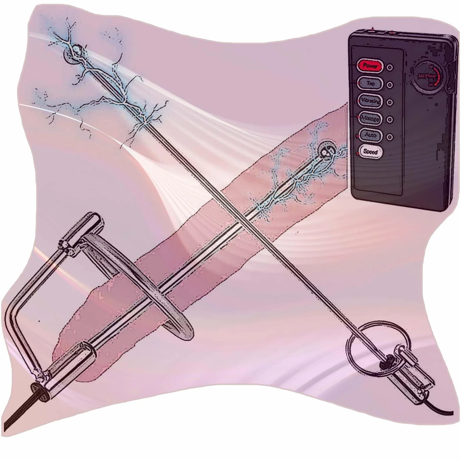 Asta sonora in acciaio inossidabile con controller, set fitness per barella di stimolazione speciale maschile -D17IT (B:10mm)