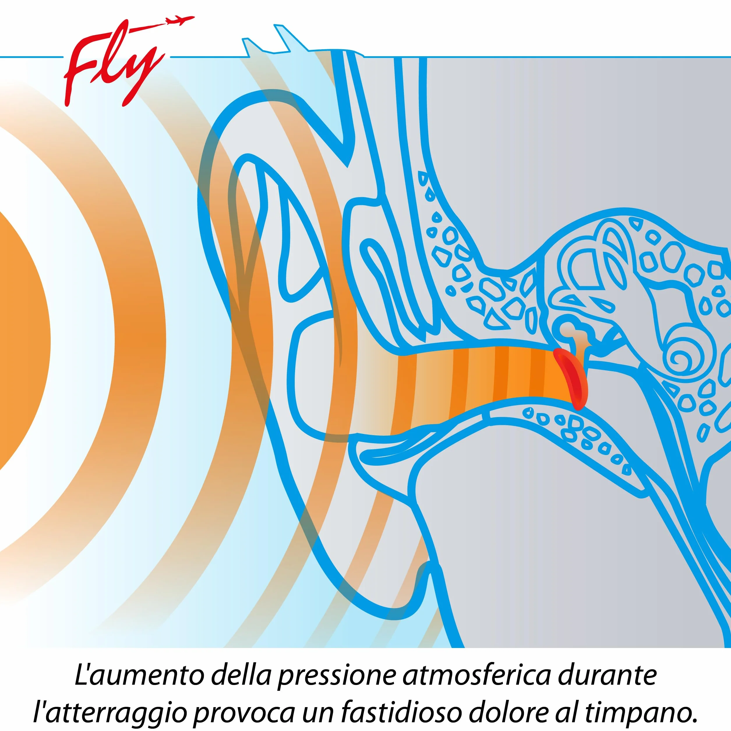 SANOHRA fly tappi per le orecchie contro la pressione in volo riutilizzabili fino a 6 voli
