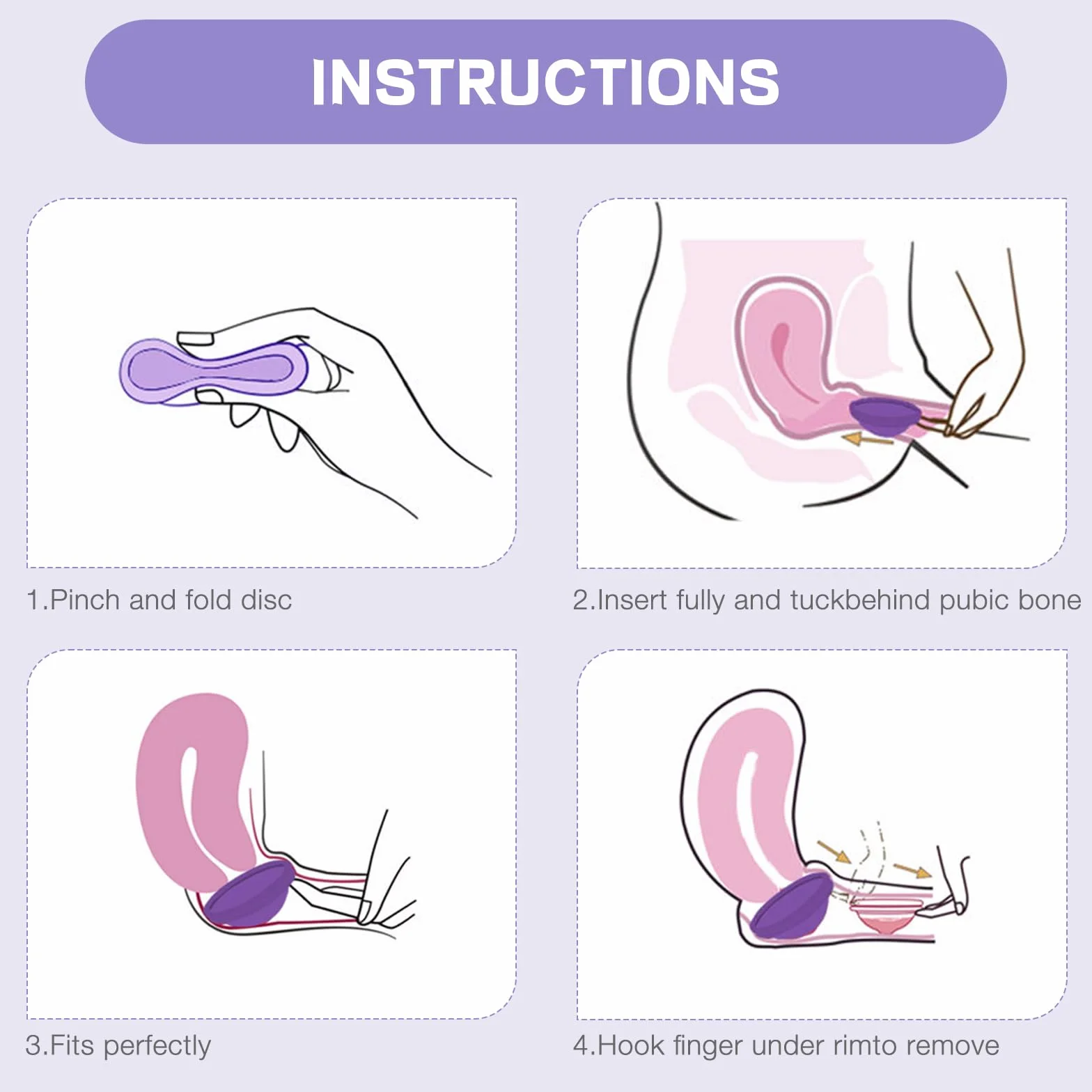Disco Mestruale, Coppetta Mestruale in Silicone, Disco Menstruale, Disco Periodico Riutilizzabile, Coppetta Mestruale morbida, Tenuta Stagna Alternativa ai Tamponi (S+L)