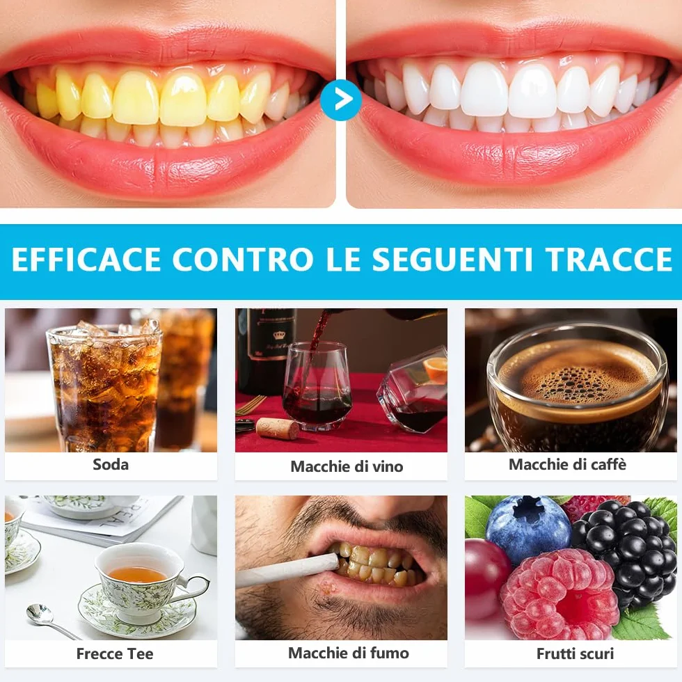Kit Sbiancante Denti Professionale con Lampada 16 LED Blu,Quattro Penne Gel Sbiancante,Elimina le Macchie in 16 Minuti,con Applicazione Semplice e Veloce,Sicuro per lo Smalto