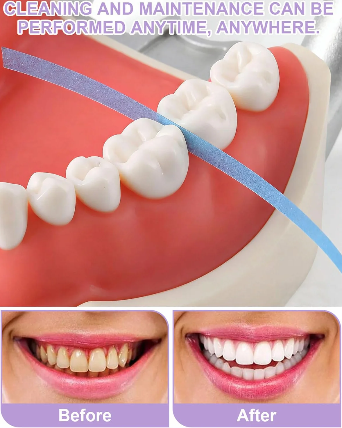 60 Pezzi Carta Vetrata Dentale,Carta Abrasiva Dentale per Fessure,Carta Abrasiva Dentale,Strisce per Lucidare i Denti Portatili,Lucidatura Dei Denti,Rimozione Del Tartaro