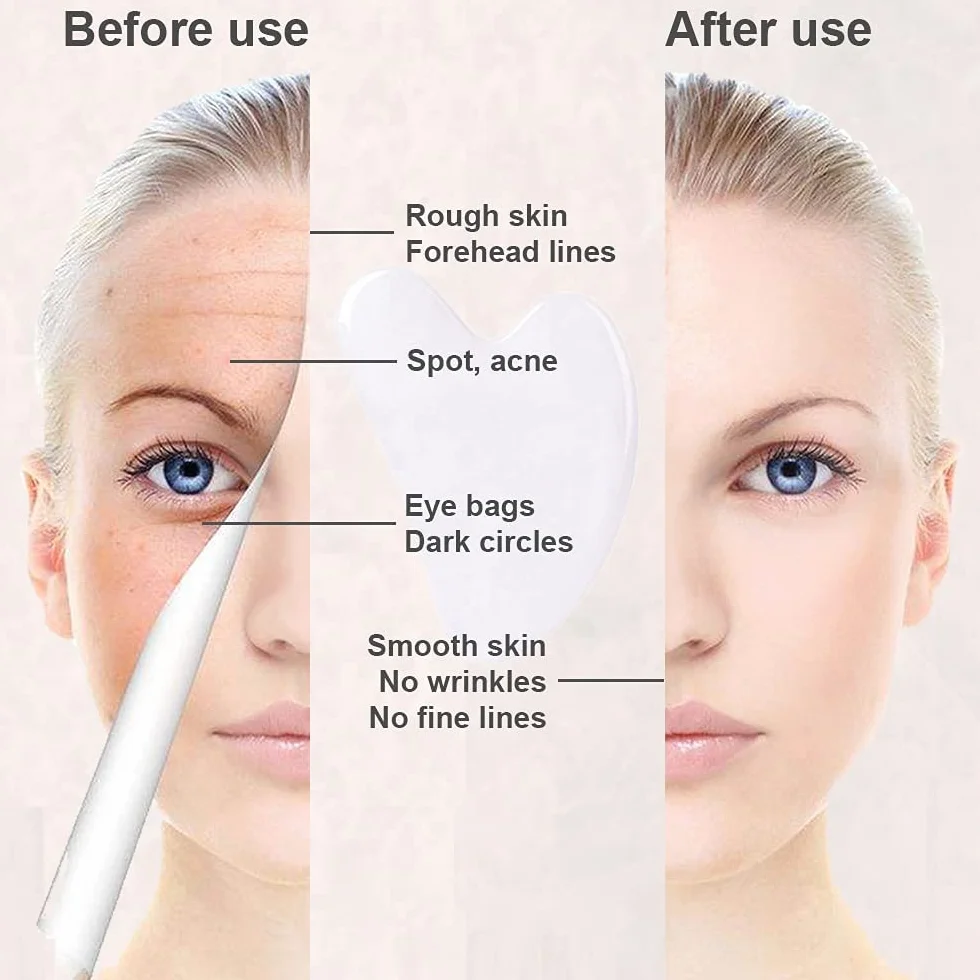 Gua Sha, Gua Sha Viso Ridurre le Linee Sottili e le Rughe, massaggi per terapia fisica e terapia di agopuntura per viso, occhi, collo e corpo (Bianco)