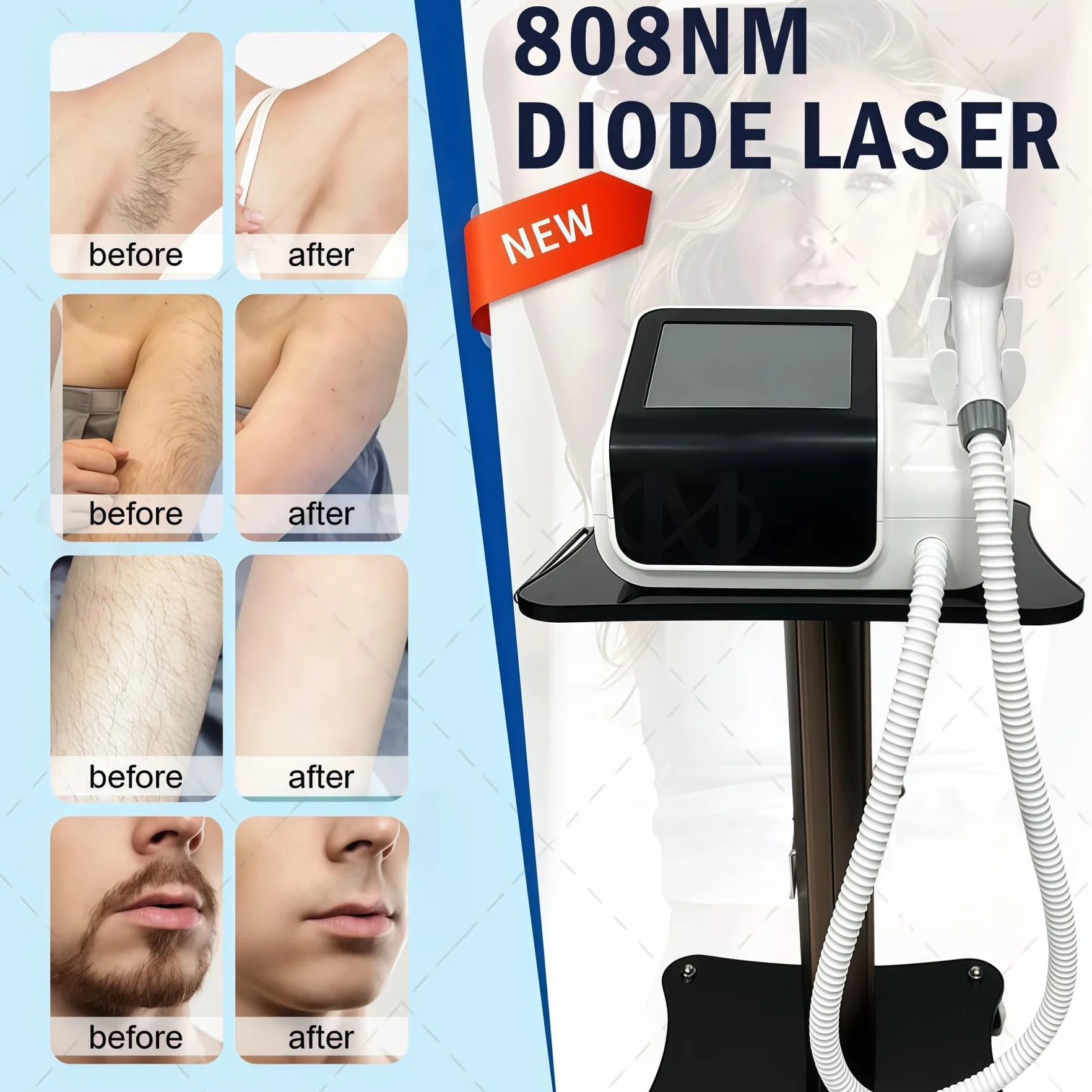 Nuovo depilatore laser a diodo 808nm aggiornato nel 2026, depilatore completo professionale di classe salone per tutti i colori della pelle, certificazione CE