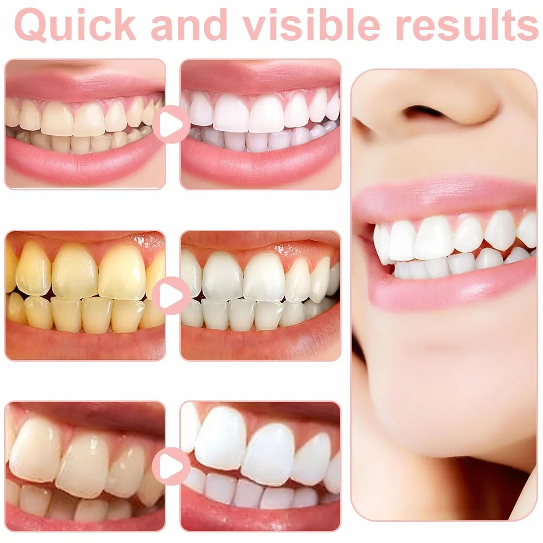 14pcs Sbiancante Denti Strisce Sbiancanti Denti, Elimina Macchie di Caffè, Vino e Tabacco