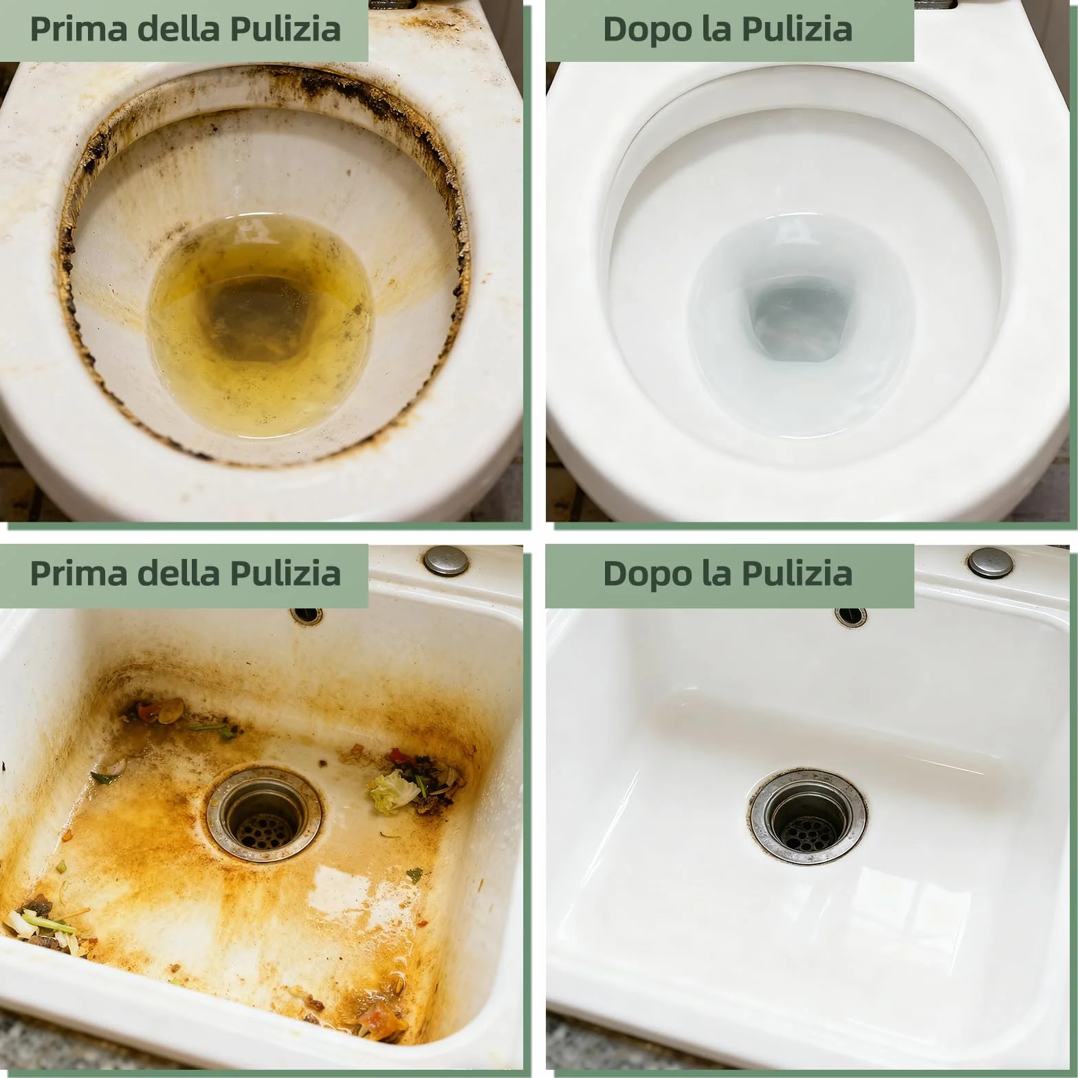 Pietra Pomice per WC 5 Pezzi con Manico Riutilizzabile - Disincrostante Calcare e Urina Ostinate
