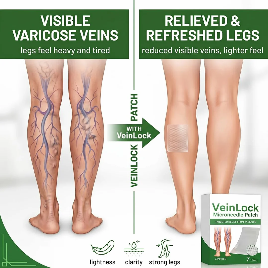 Cerotto Microaghi Per Gambe, Con Effetto Termico, Supporta La Muscolatura Delle Gambe, Migliora Il Benessere, Traspirante, Delicato Sulla Pelle, Facile Da Applicare