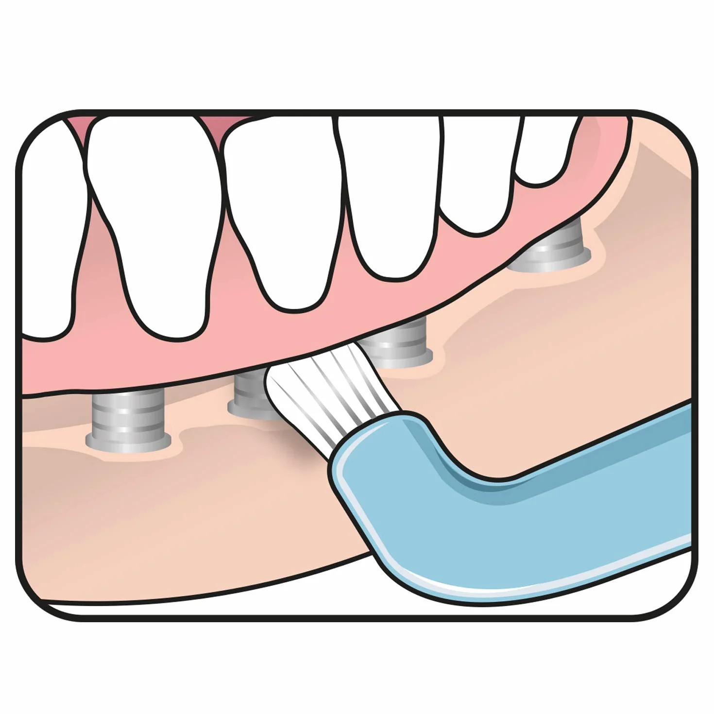 TEPE Compact Tuft Spazzolino da denti con testina rotonda per una pulizia accurata della bocca anche in impianti o protesi colorati Assortiti