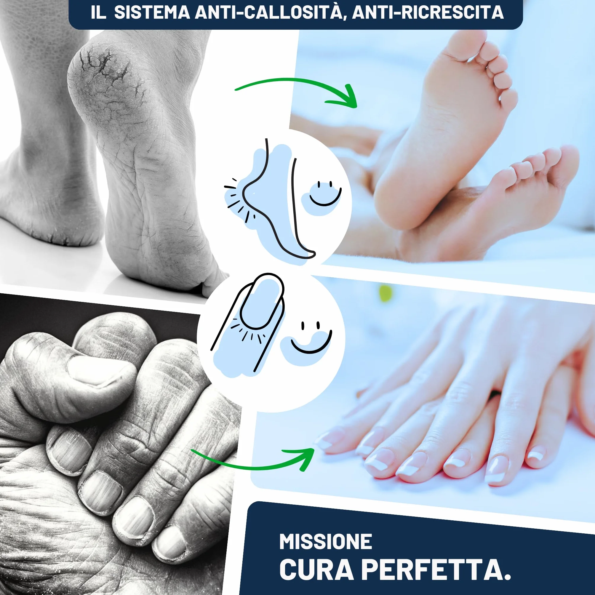 Mr. Fuss N. 4 Advanced Pack Complete Grande 5 Pezzi Soluzione Attiva Ammorbidente Rapido 500 ml Balsamo N. 2 200 ml Set Cuticole