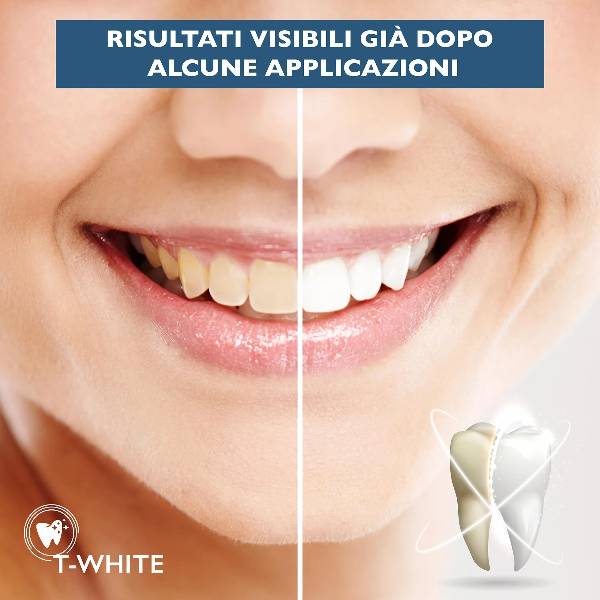 Ricarica Sbiancante Denti Professionale con 3 Gel Sbiancanti e Pennello - Sbiancamento in 16 Minuti