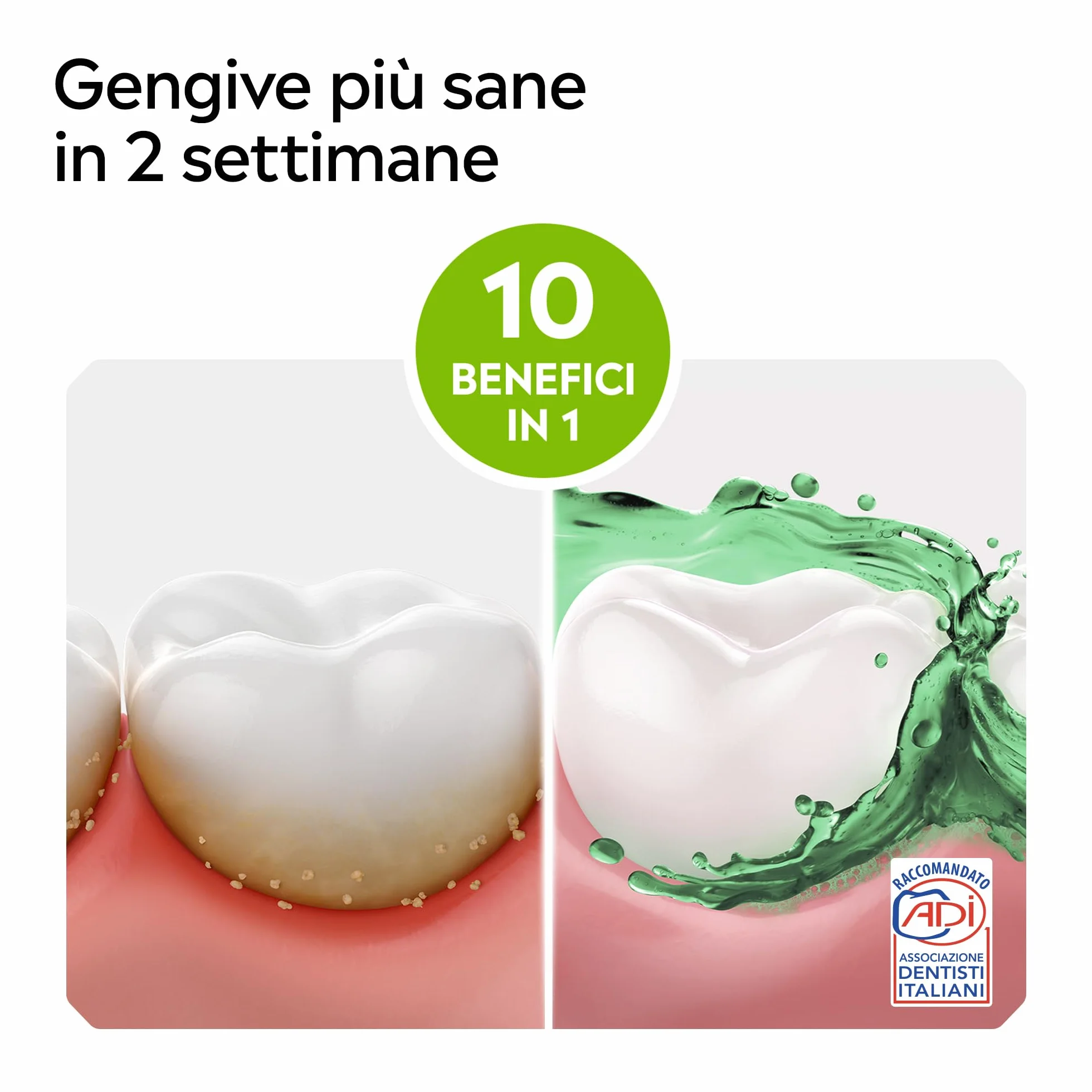 LISTERINE Total Care Denti e Gengive Collutorio al Fluoro Menta Fresca 2x1L