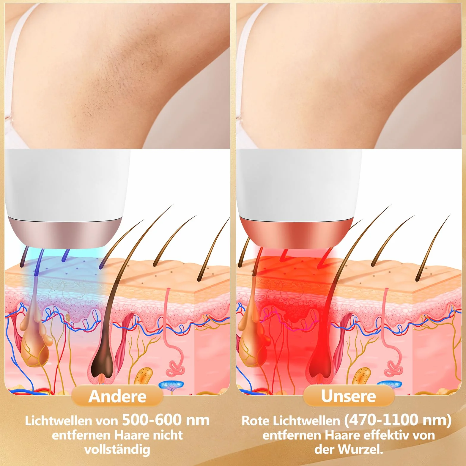IPL Depilazione - Depilazione indolore e permanente con luce pulsata intensa (IPL) per viso e corpo, ideale per uso domestico, bianco