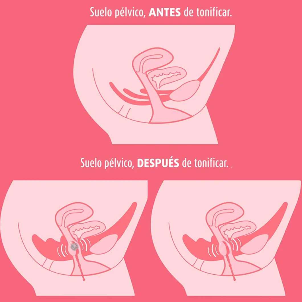Enna Esfera Suelo Pelvico