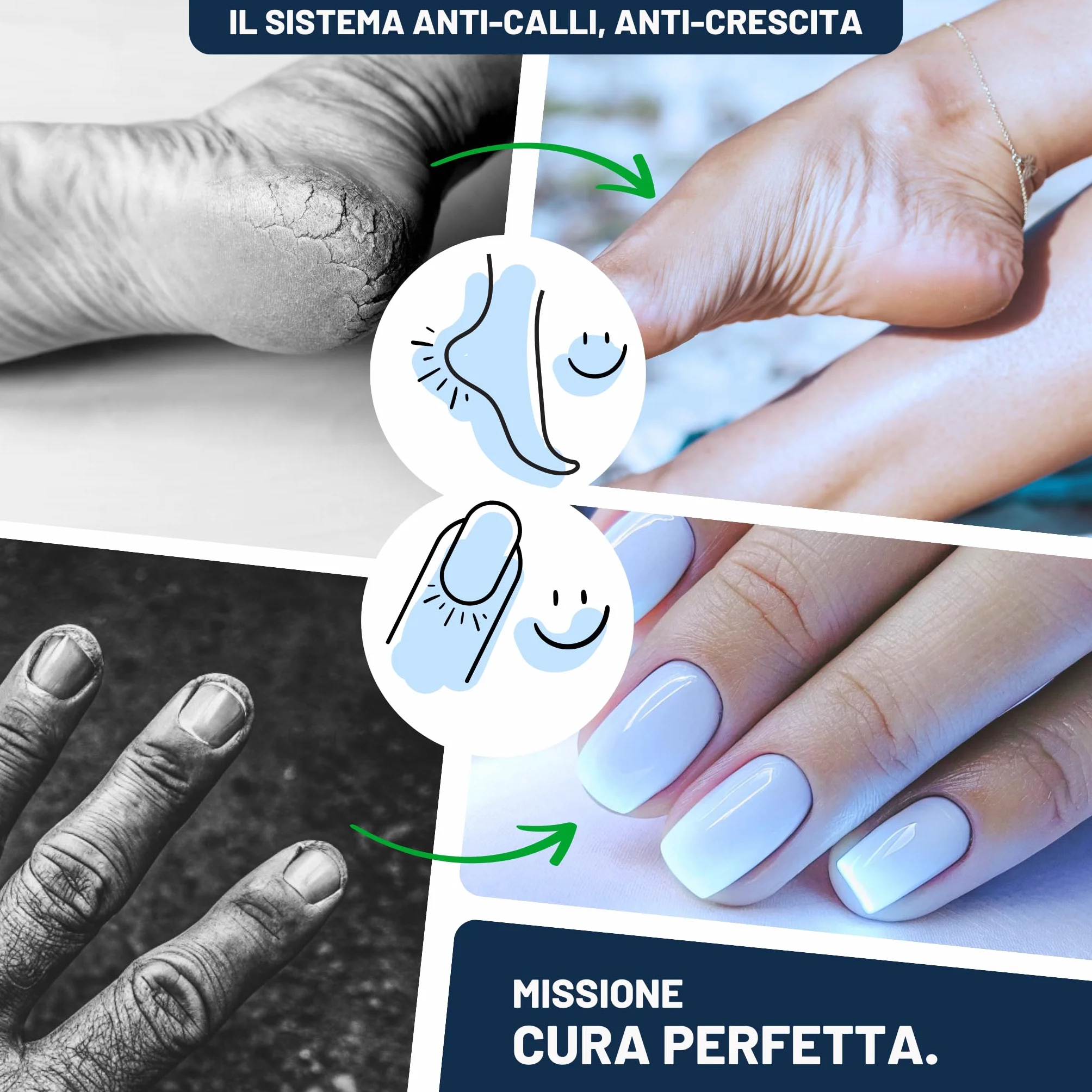 Mr. Fuss No. 1 Soluzione, Kit Callifugo Per Piedi, 3 Parti, Liquido Cheratolitico Extra Forte