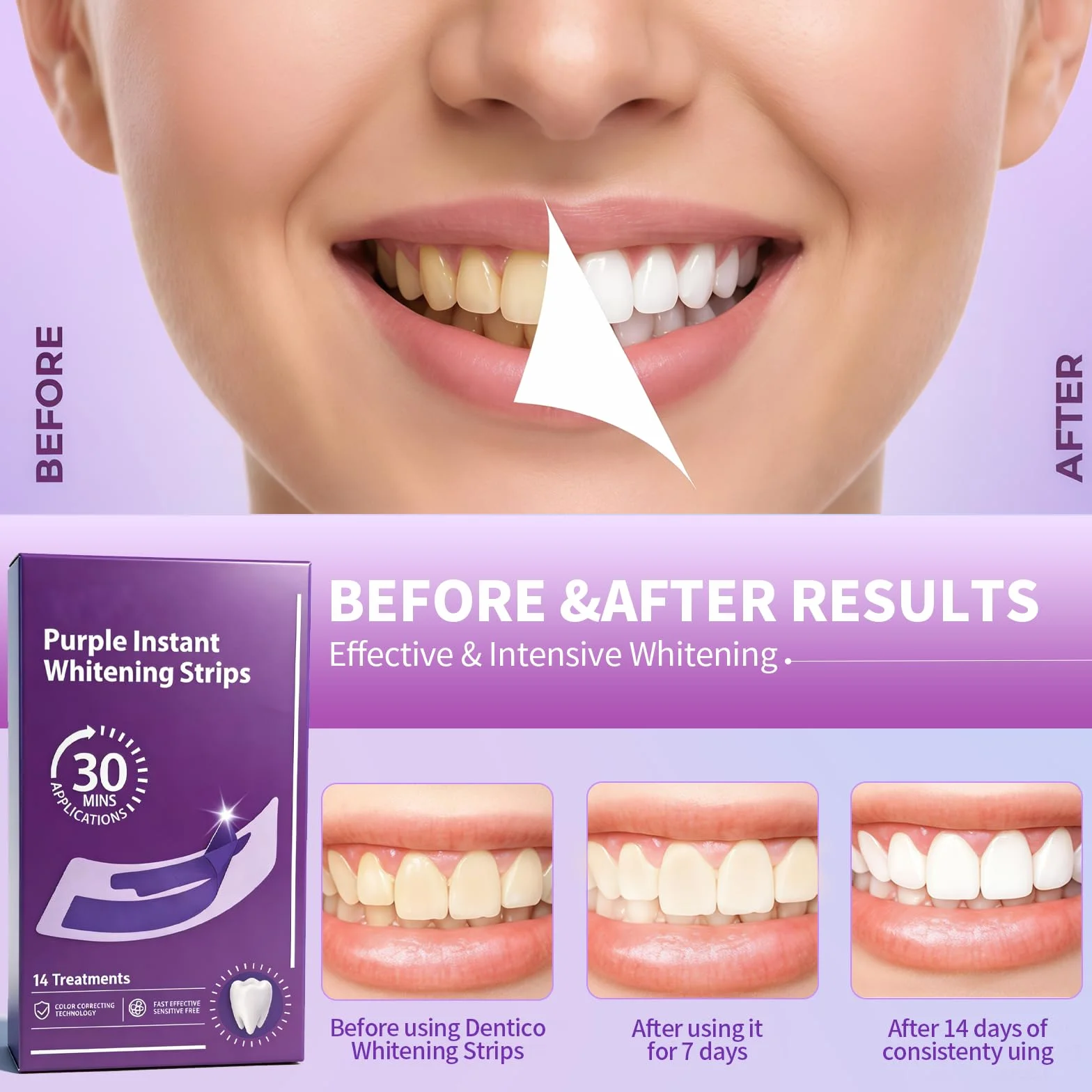 Strisce Sbiancanti Denti 28 Pezzi, Kit Sbiancante Rapido & Efficace